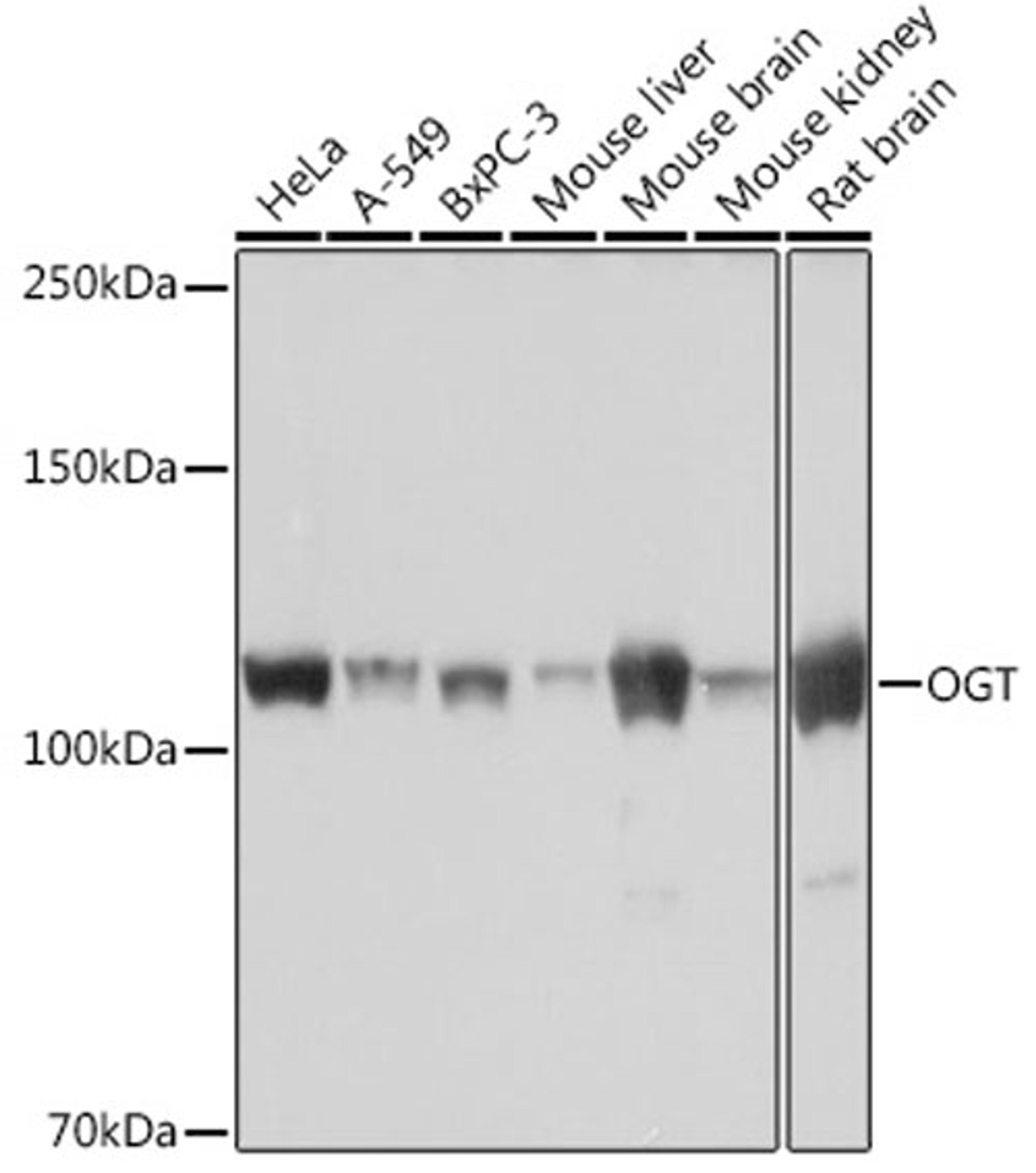 Western blot - OGT Rabbit mAb (A3501)