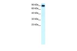 Antibody used in WB on Human Liver at 0.1 ug/ml.