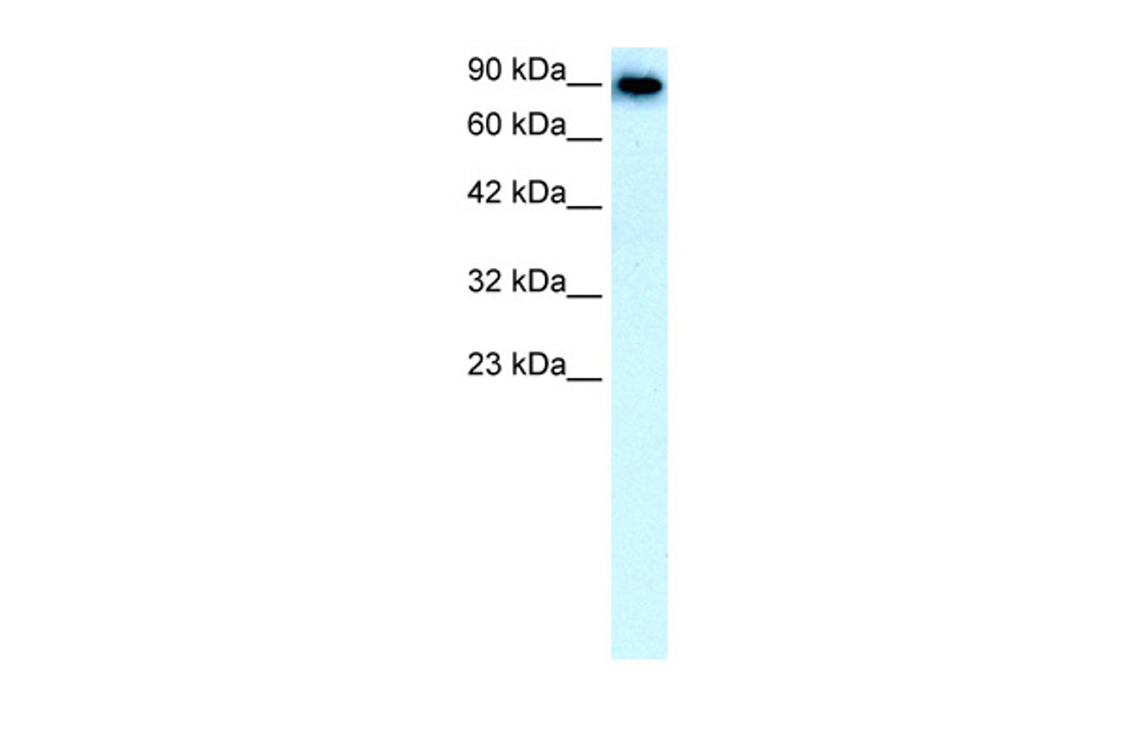 Antibody used in WB on Human Liver at 0.1 ug/ml.