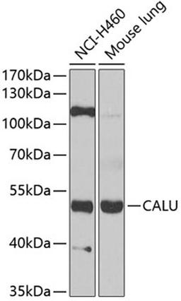 Western blot - CALU antibody (A6538)