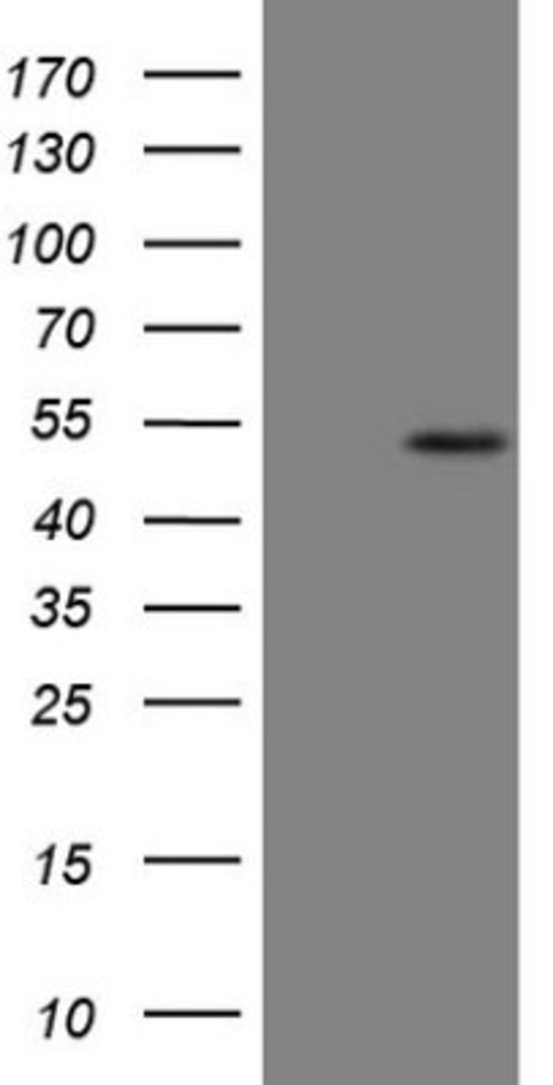 Western Blot: B4GALT4 Antibody (8B6) [NBP2-46562] - Analysis of HEK293T cells were transfected with the pCMV6-ENTRY control (Left lane) or pCMV6-ENTRY B4GALT4.