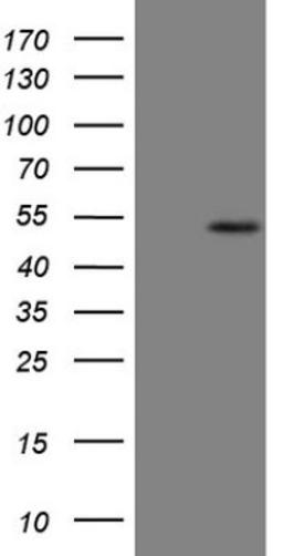 Western Blot: B4GALT4 Antibody (8B6) [NBP2-46562] - Analysis of HEK293T cells were transfected with the pCMV6-ENTRY control (Left lane) or pCMV6-ENTRY B4GALT4.