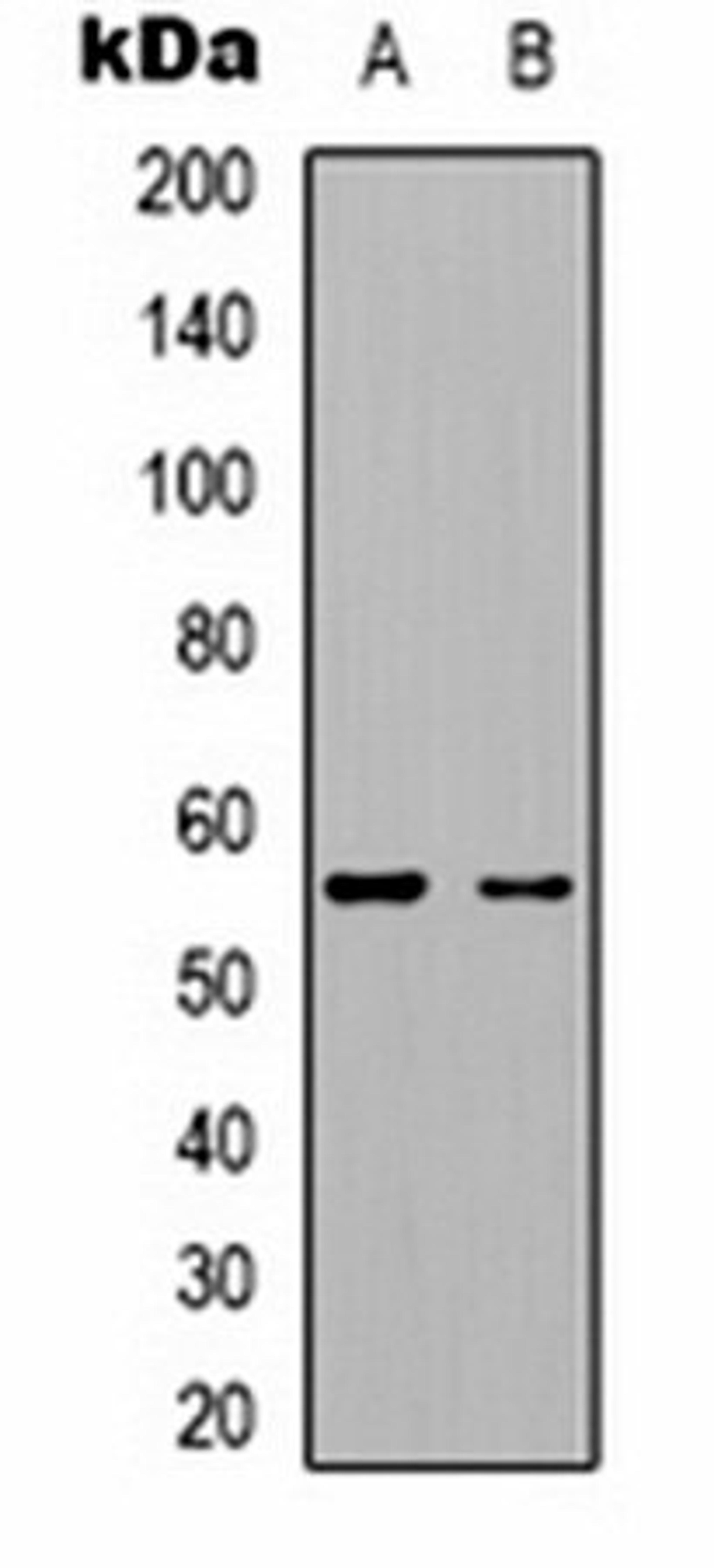 Western blot analysis of  mouse brain (Lane1), rat brain (Lane2) whole cell lysates using Kv1.1 antibody