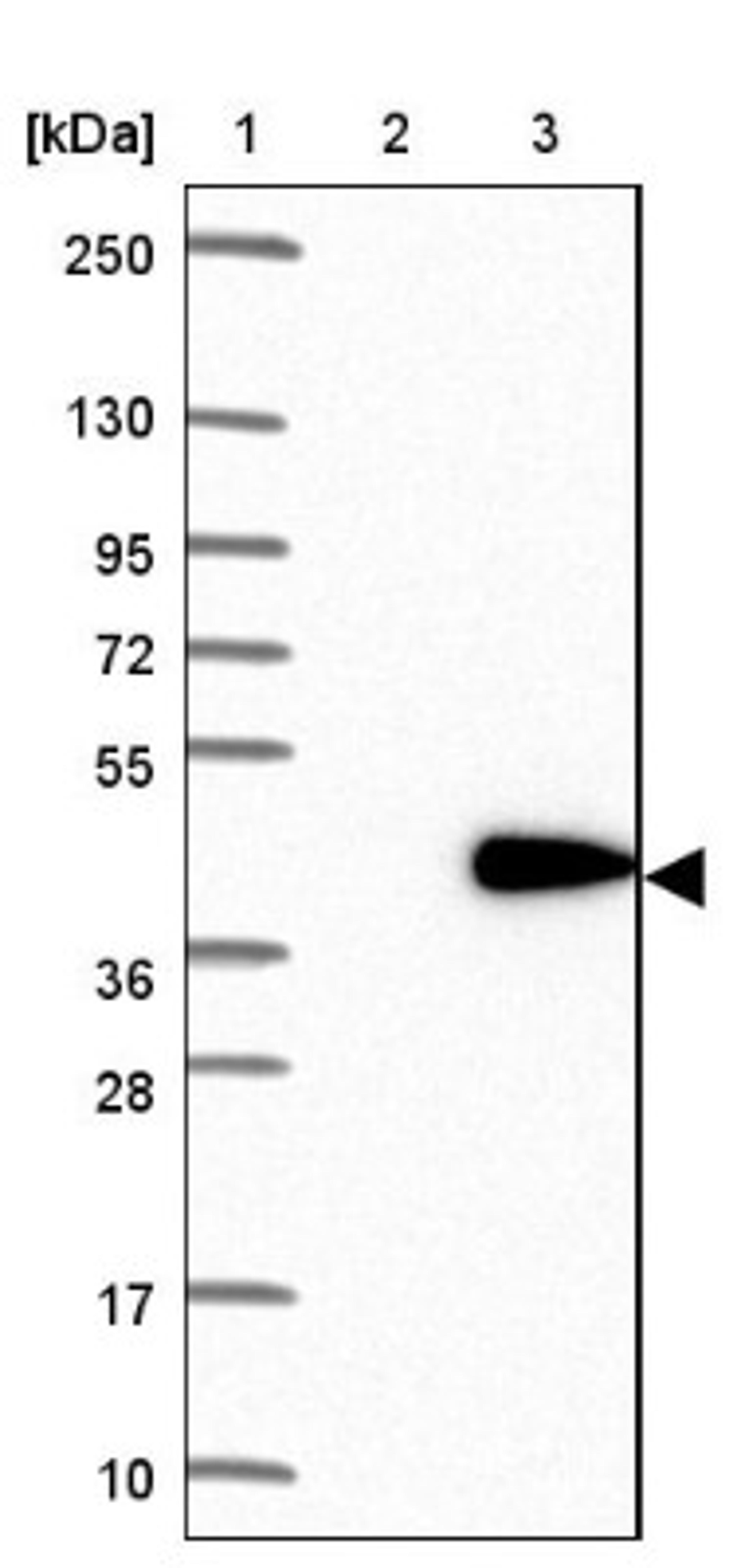 Western Blot: RDM1 Antibody [NBP1-82708] - Lane 1: Marker [kDa] 250, 130, 95, 72, 55, 36, 28, 17, 10<br/>Lane 2: Negative control (vector only transfected HEK293T lysate)<br/>Lane 3: Over-expression lysate (Co-expressed with a C-terminal myc-DDK tag (~3.1 kDa) in mammalian HEK293T cells, LY407910)