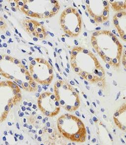 Immunohistochemical analysis of paraffin-embedded H. kidney section using PGK1 Antibody . Antibody was diluted at 1:100 dilution. A peroxidase-conjugated goat anti-rabbit IgG at 1:400 dilution was used as the secondary antibody, followed by DAB staining.