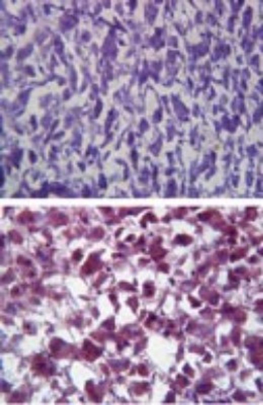 Immunohistochemistry-Paraffin: Catalase Antibody [NBP2-24916] - Staining of human liver tissue using an isotype control (top) and this antibody (bottom) at 5 ug/ml.