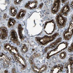 Immunohistochemistry-Paraffin: PCTAIRE2 Antibody [NBP1-87316] - Staining of human kidney shows distinct cytoplasmic and membranous positivity in cells in tubules, cells in glomeruli are negative.