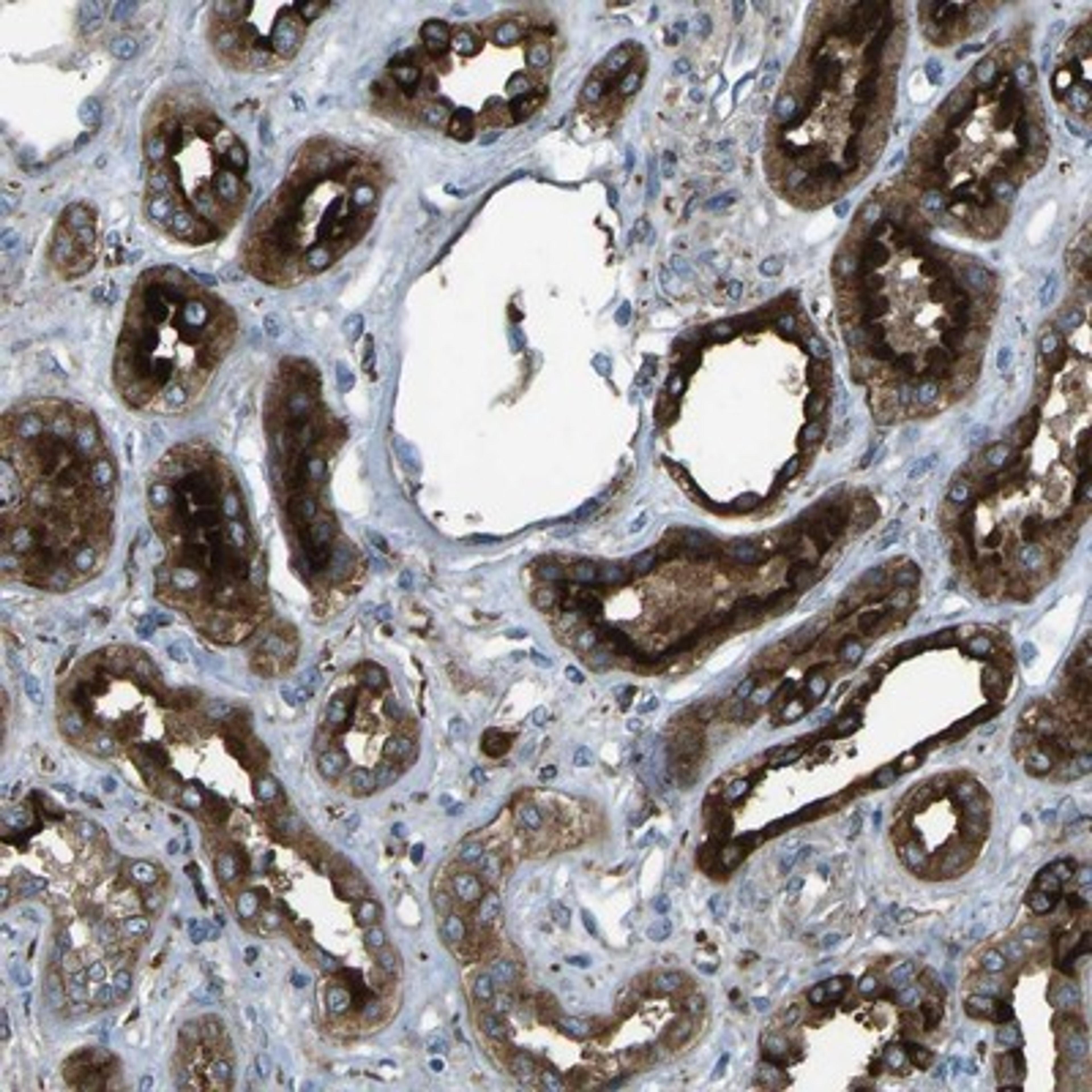 Immunohistochemistry-Paraffin: PCTAIRE2 Antibody [NBP1-87316] - Staining of human kidney shows distinct cytoplasmic and membranous positivity in cells in tubules, cells in glomeruli are negative.