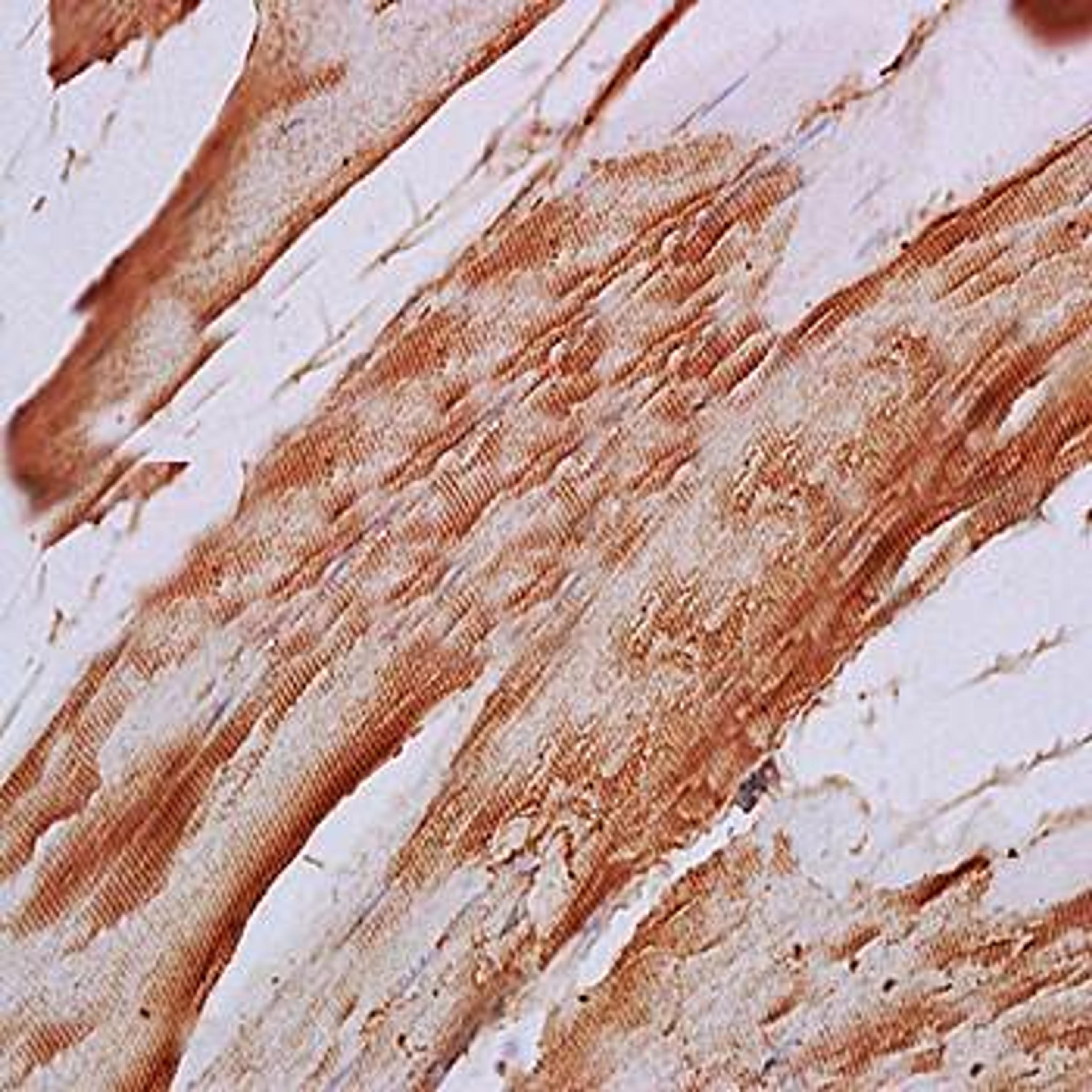 Immunohistochemical analysis of formalin-fixed and paraffin embedded rat skeletal muscle tissue (dilution at:1:200) using F-Actin antibody