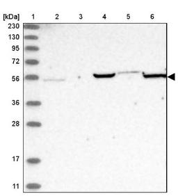 Immunohistochemistry: ADA2 beta Antibody [NBP1-91649] - Lane 1: Marker [kDa] 230, 130, 95, 72, 56, 36, 28, 17, 11<br/>Lane 2: Human cell line RT-4<br/>Lane 3: Human cell line U-251MG sp<br/>Lane 4: Human plasma (IgG/HSA depleted)<br/>Lane 5: Human liver tissue<br/>Lane 6: Human tonsil tissue