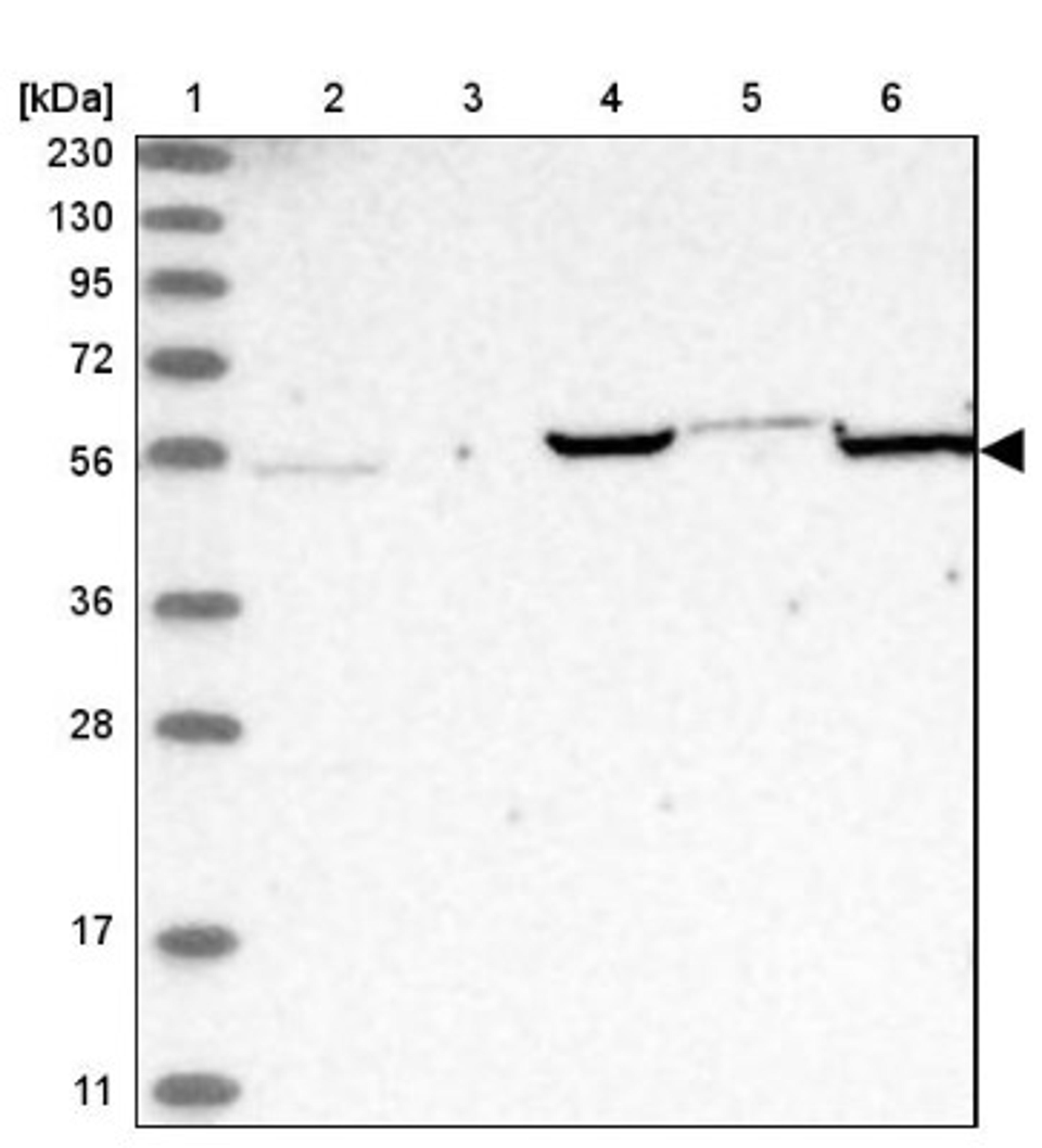 Immunohistochemistry: ADA2 beta Antibody [NBP1-91649] - Lane 1: Marker [kDa] 230, 130, 95, 72, 56, 36, 28, 17, 11<br/>Lane 2: Human cell line RT-4<br/>Lane 3: Human cell line U-251MG sp<br/>Lane 4: Human plasma (IgG/HSA depleted)<br/>Lane 5: Human liver tissue<br/>Lane 6: Human tonsil tissue