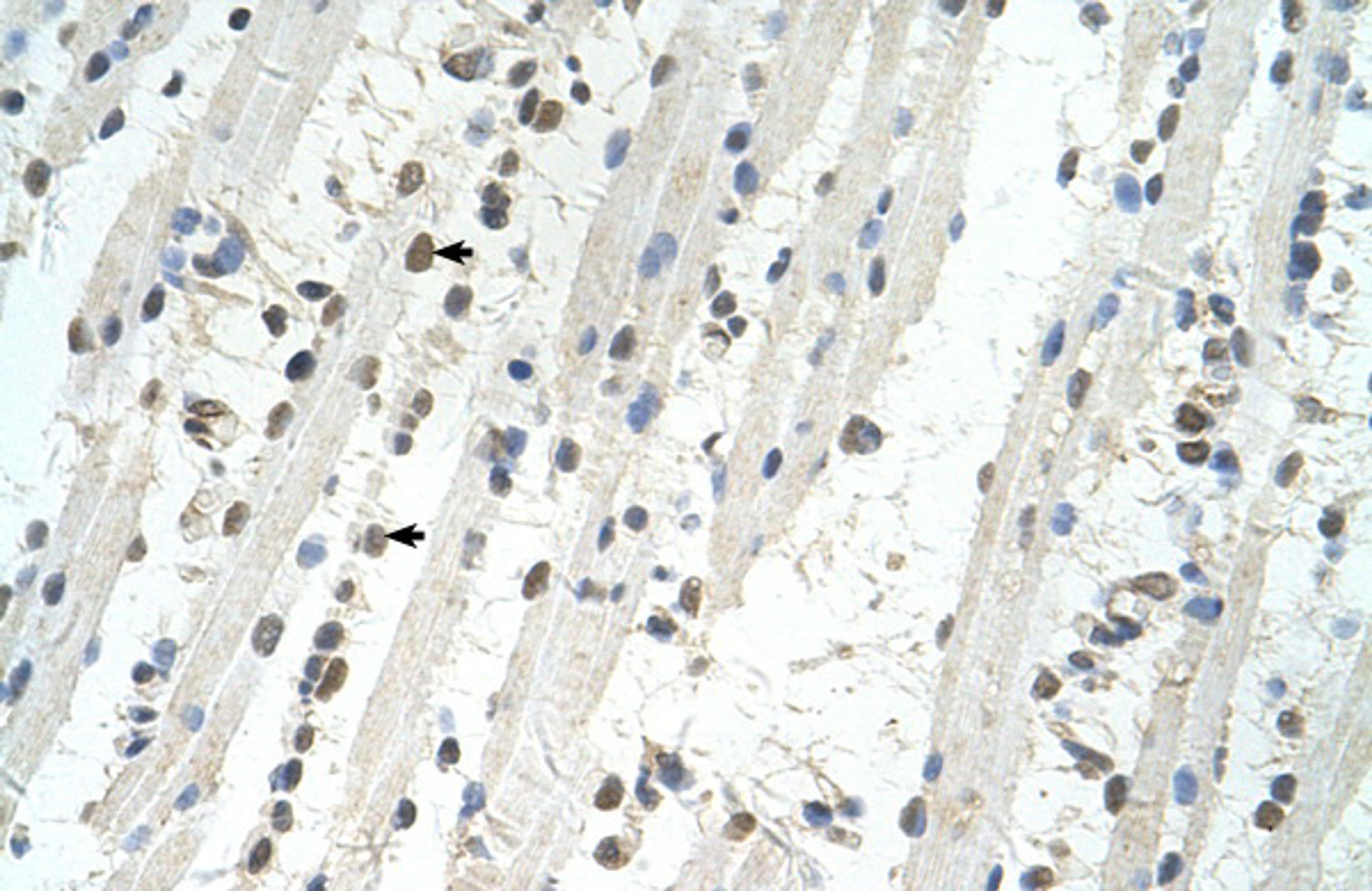 Antibody used in IHC on Human Muscle.