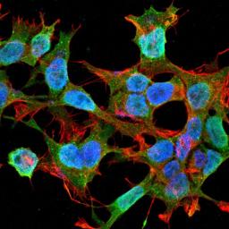 Immunofluorescence analysis of neuroblastoma cell line sk-n-be using Neuroligin 1 antibody