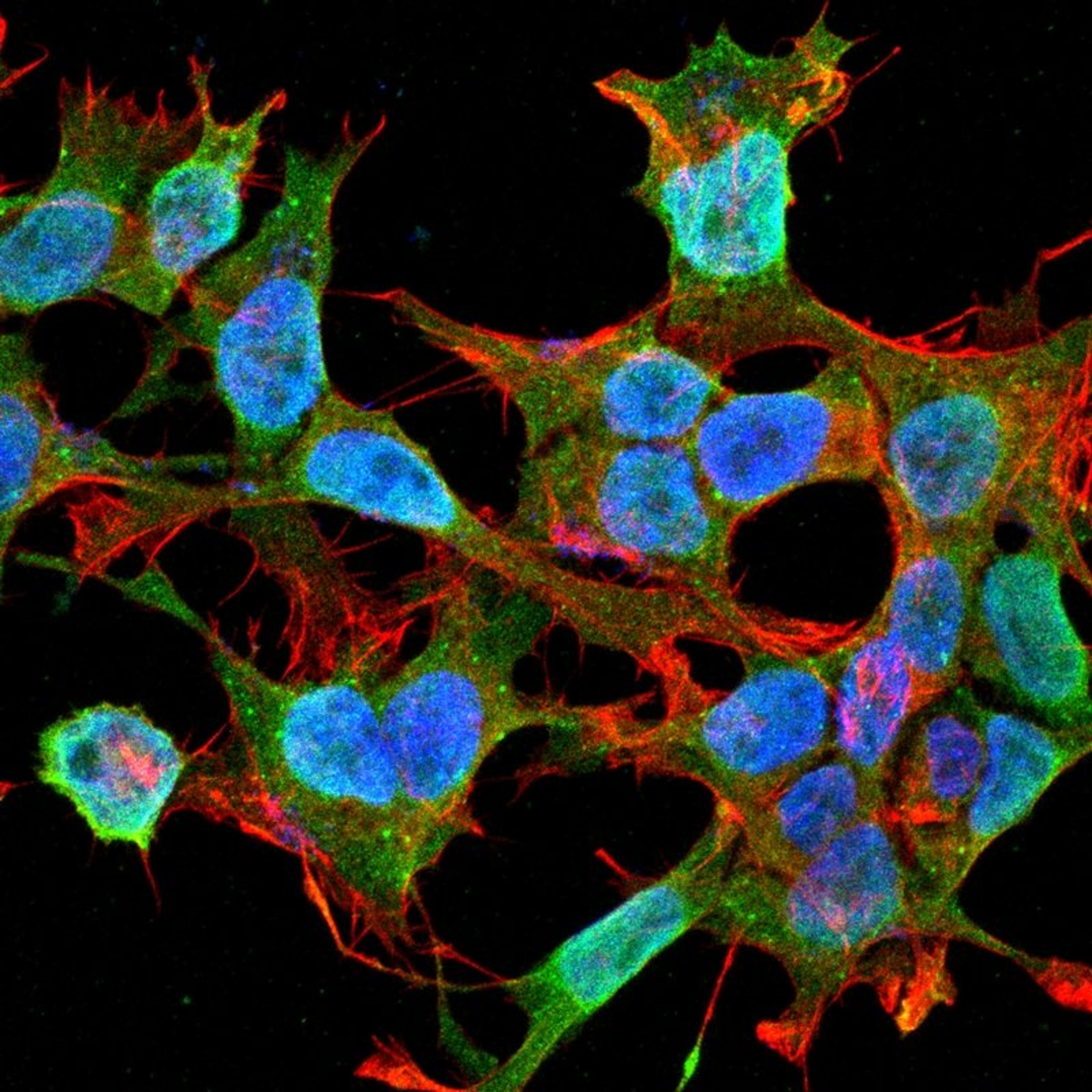 Immunofluorescence analysis of neuroblastoma cell line sk-n-be using Neuroligin 1 antibody