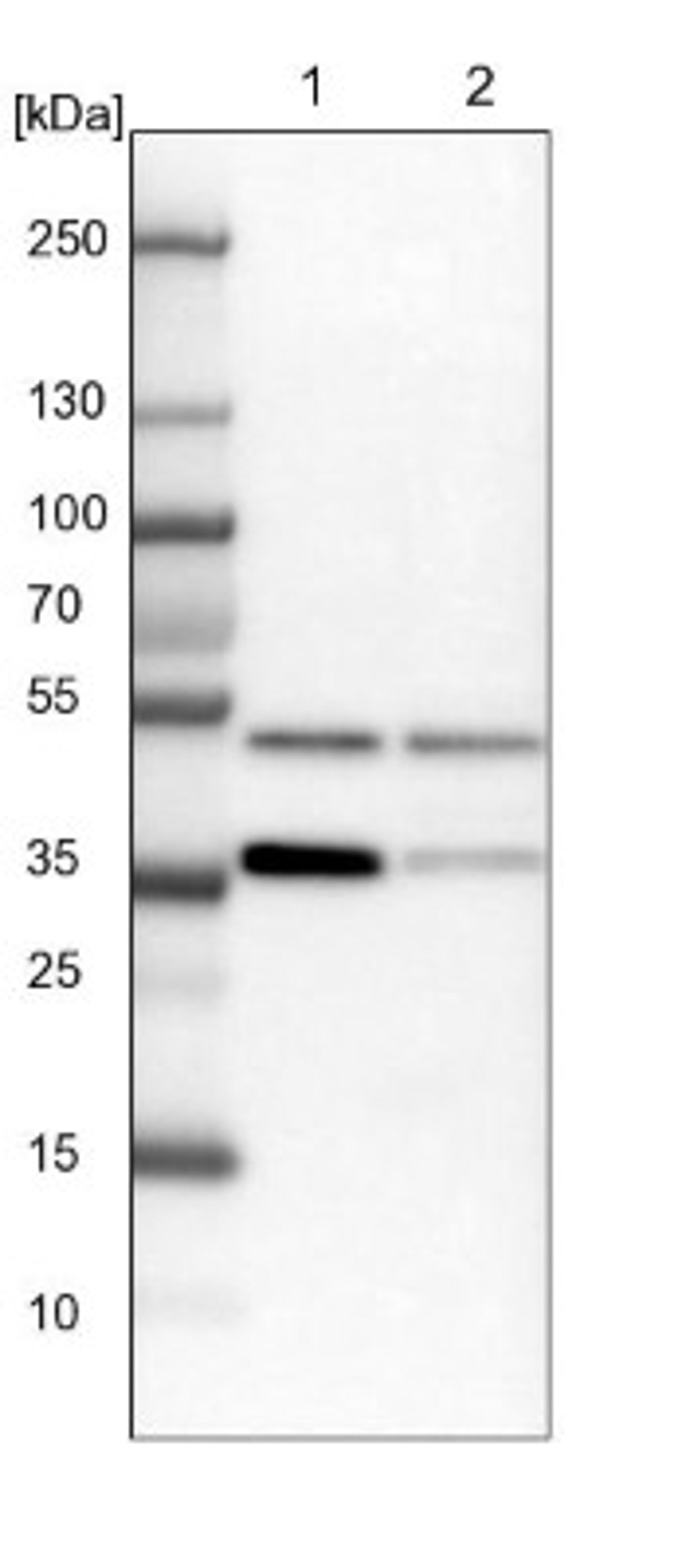 Western Blot: FEZ2 Antibody [NBP1-90909] - Lane 1: NIH-3T3 cell lysate (Mouse embryonic fibroblast cells)<br/>Lane 2: NBT-II cell lysate (Rat Wistar bladder tumour cells)