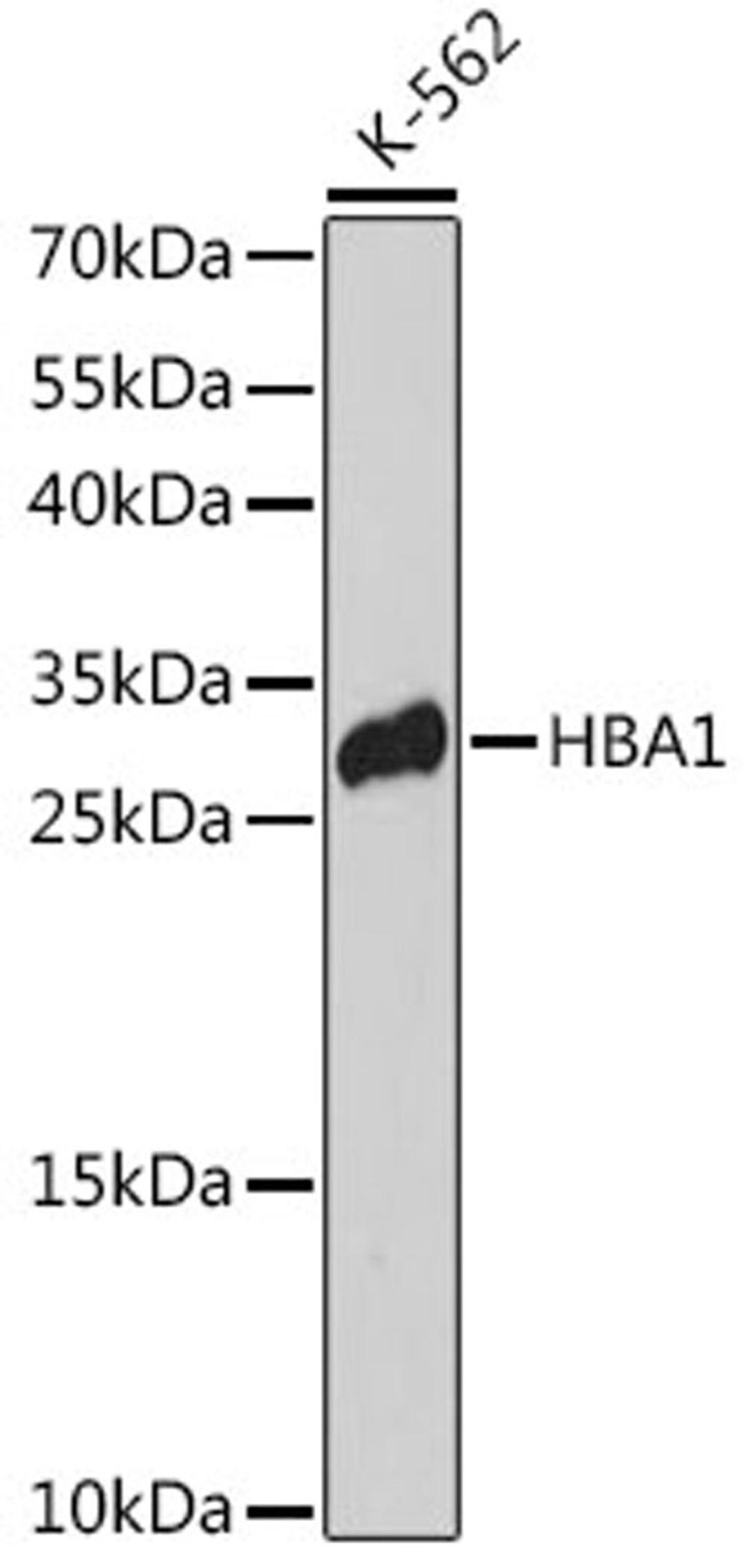 Western blot - HBA1 antibody (A14551)