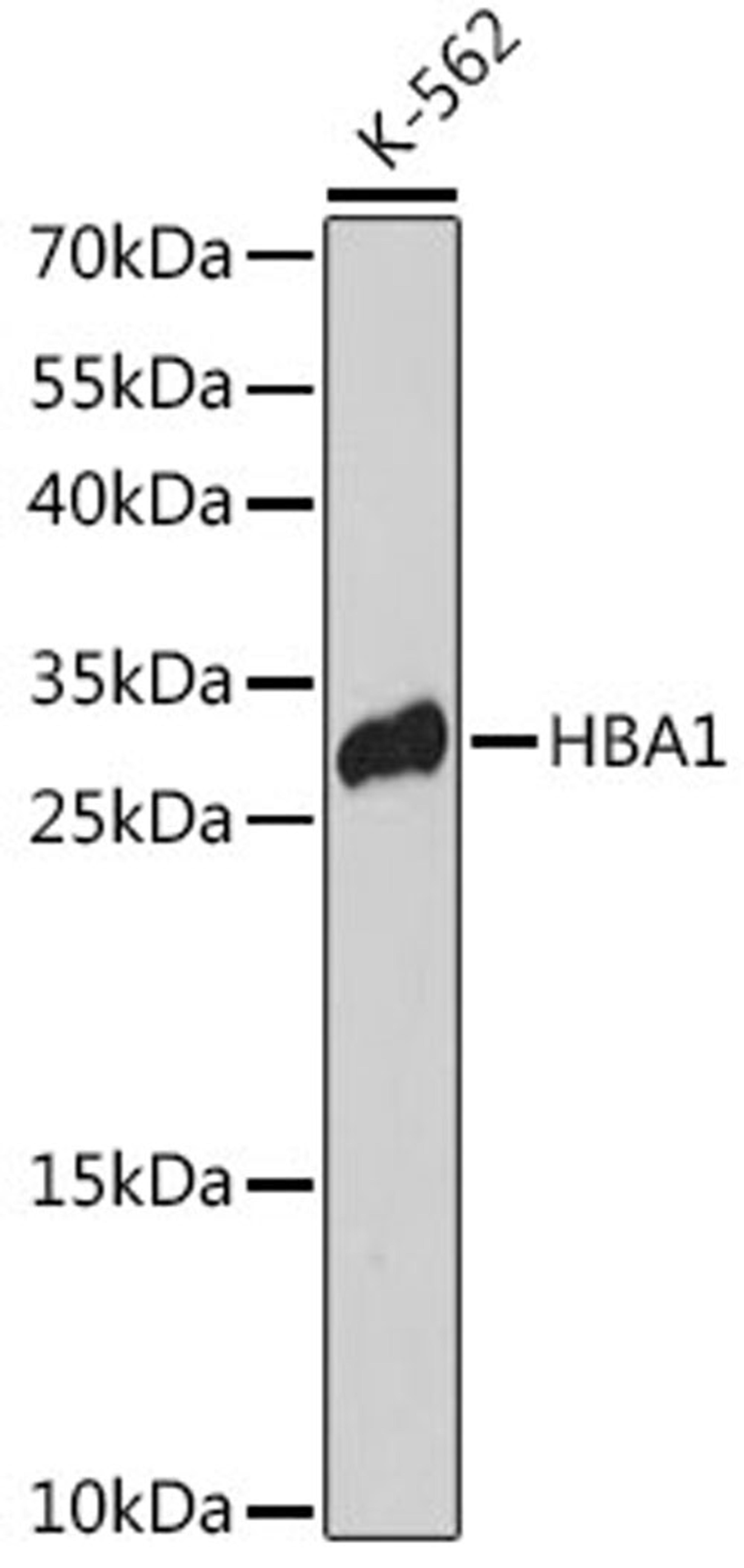 Western blot - HBA1 antibody (A14551)