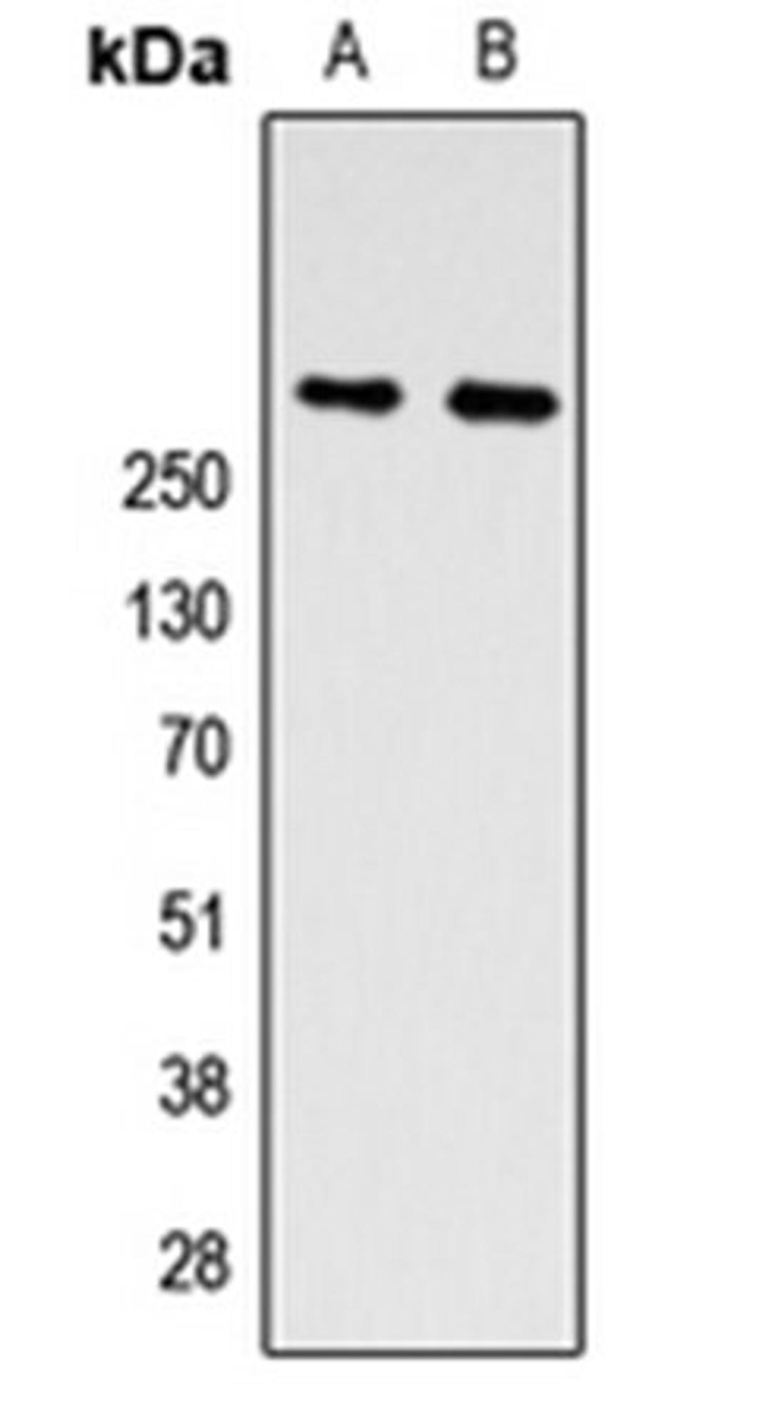 Western blot analysis of A549 (Lane 1), PC12 (Lane 2) whole cell lysates using ZNF462 antibody