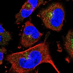 Immunocytochemistry/Immunofluorescence: SEMA3D Antibody [NBP1-85517] - Immunofluorescent staining of human cell line U-251 MG shows positivity in golgi apparatus.