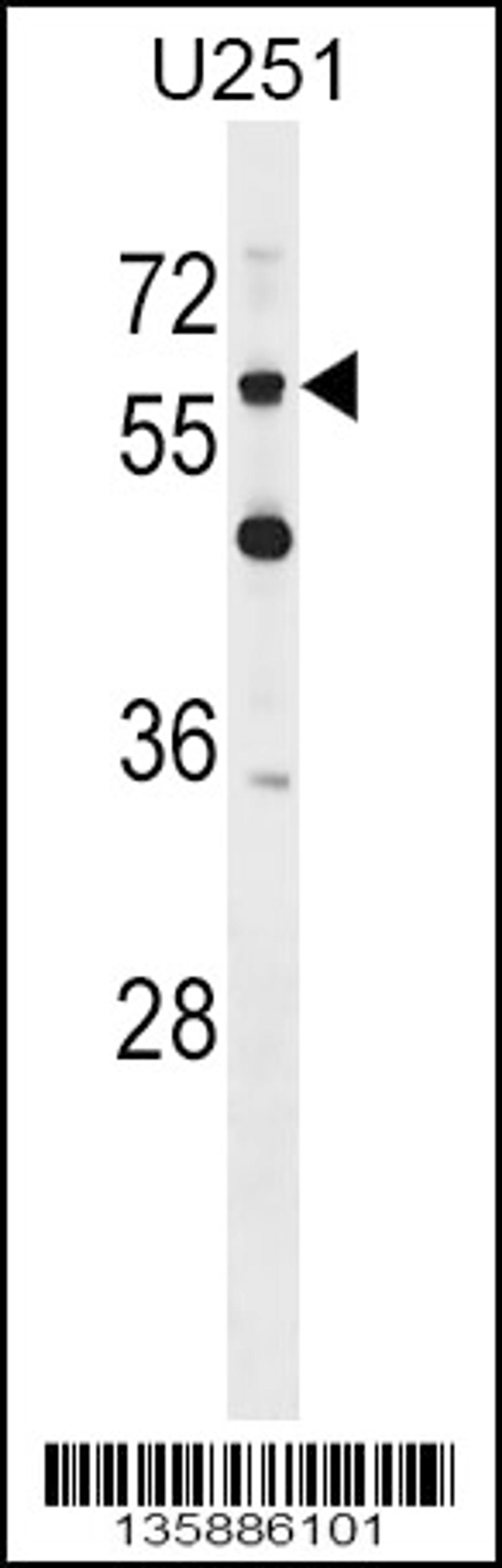 Western blot analysis in U251 cell line lysates (35ug/lane).