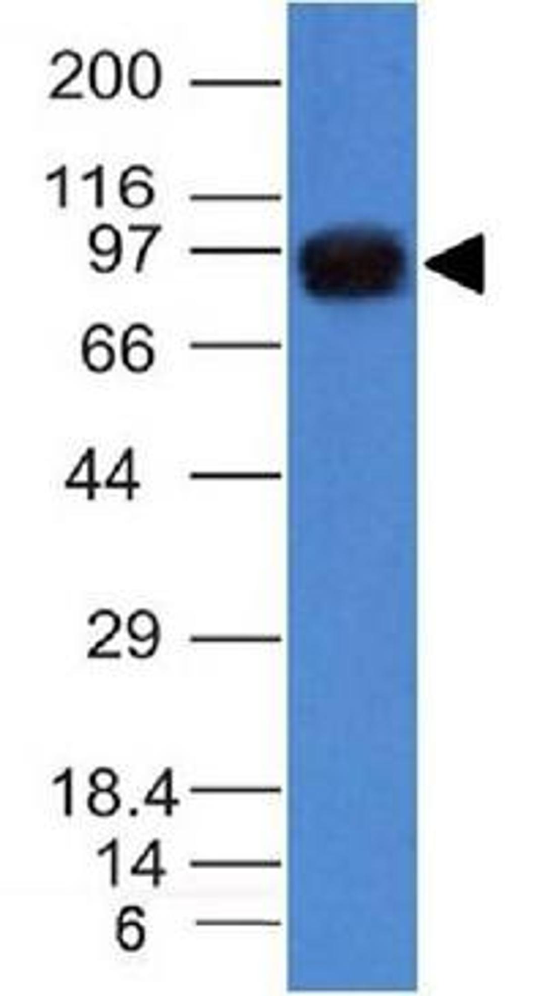 Western blot analysis of A549 Cell Lysate tissue using UACA antibody