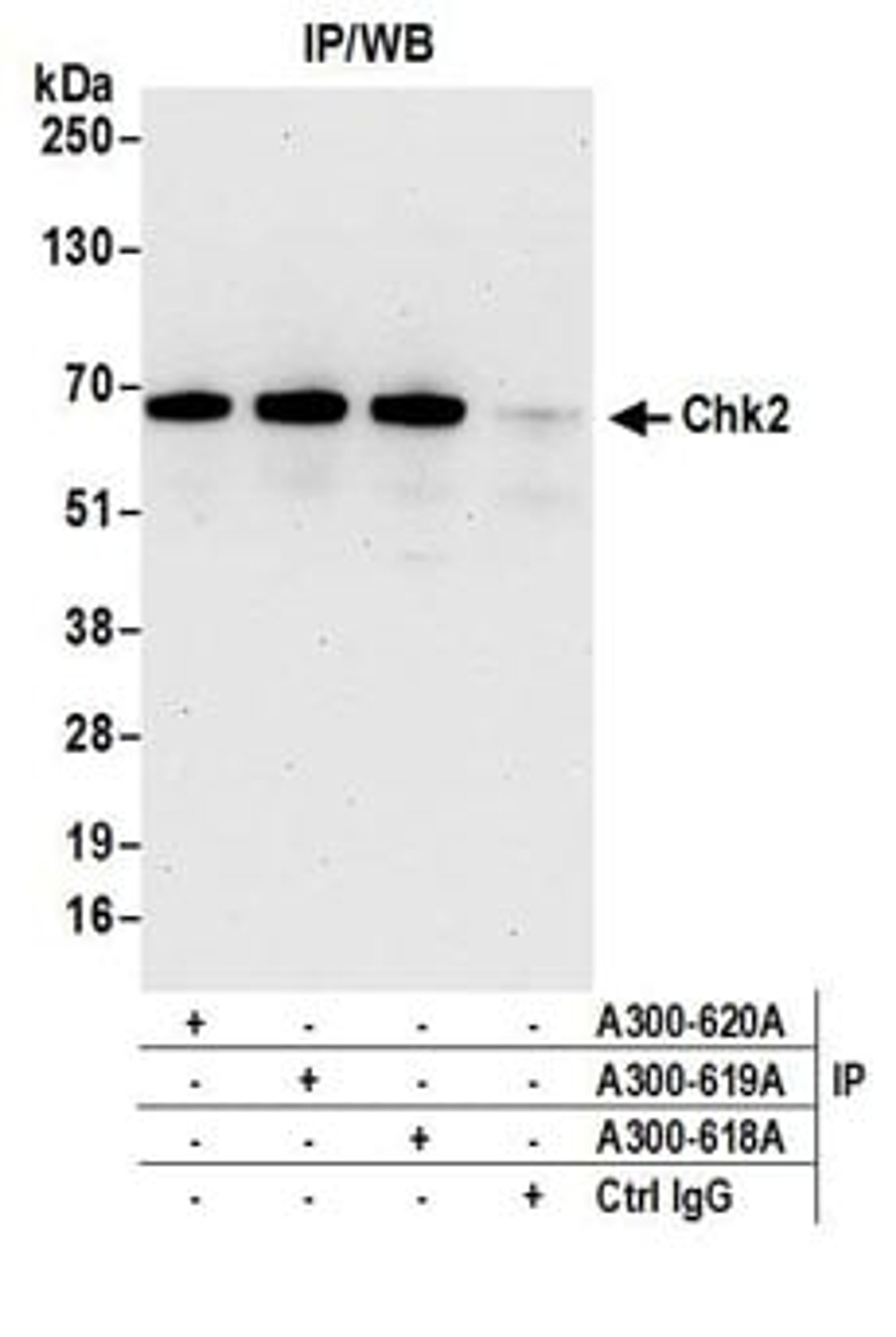 Detection of human Chk2 by western blot of immunoprecipitates.