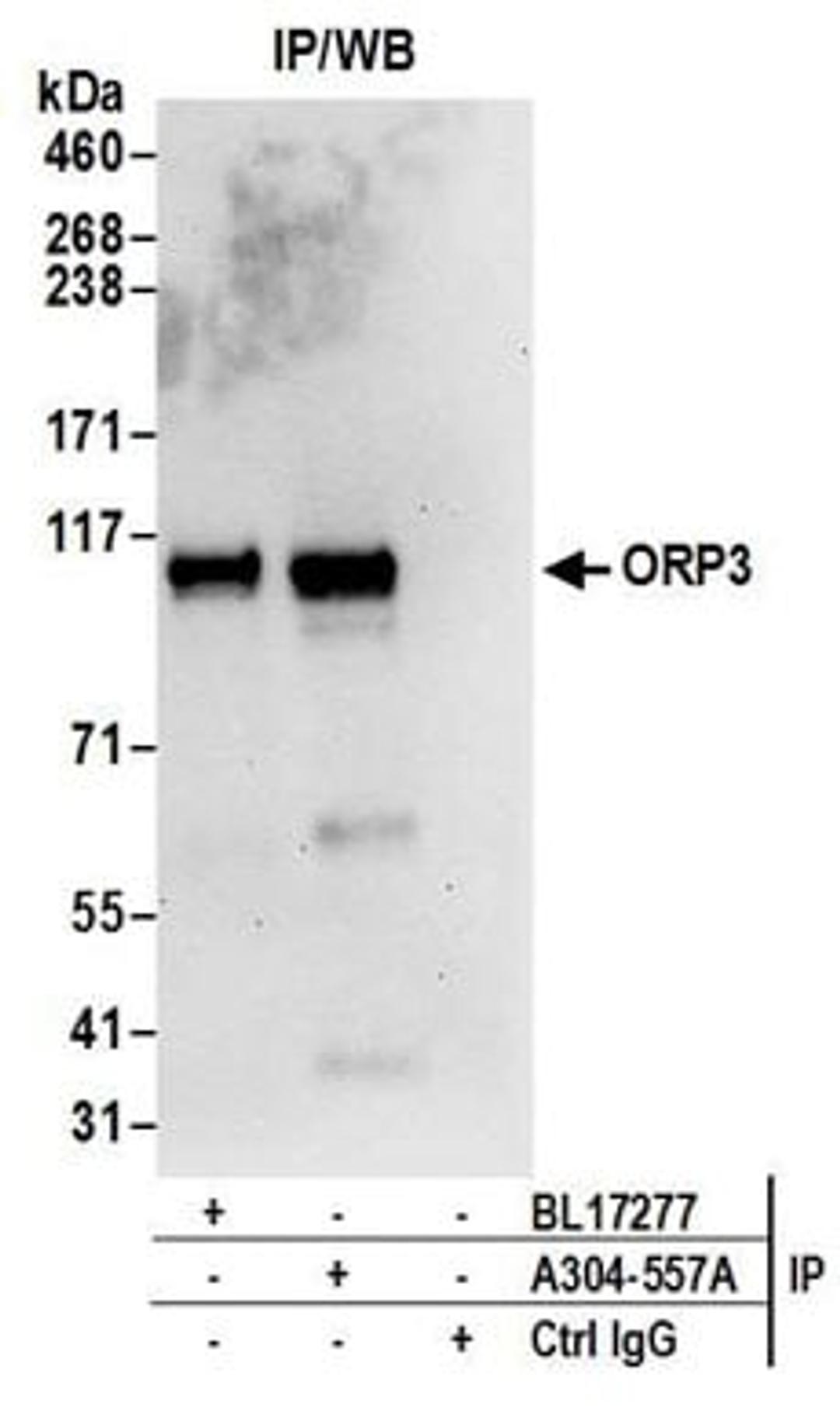 Detection of human ORP3 by western blot of immunoprecipitates.