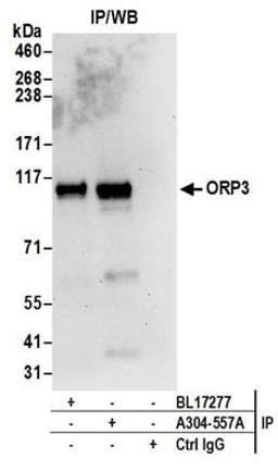 Detection of human ORP3 by western blot of immunoprecipitates.