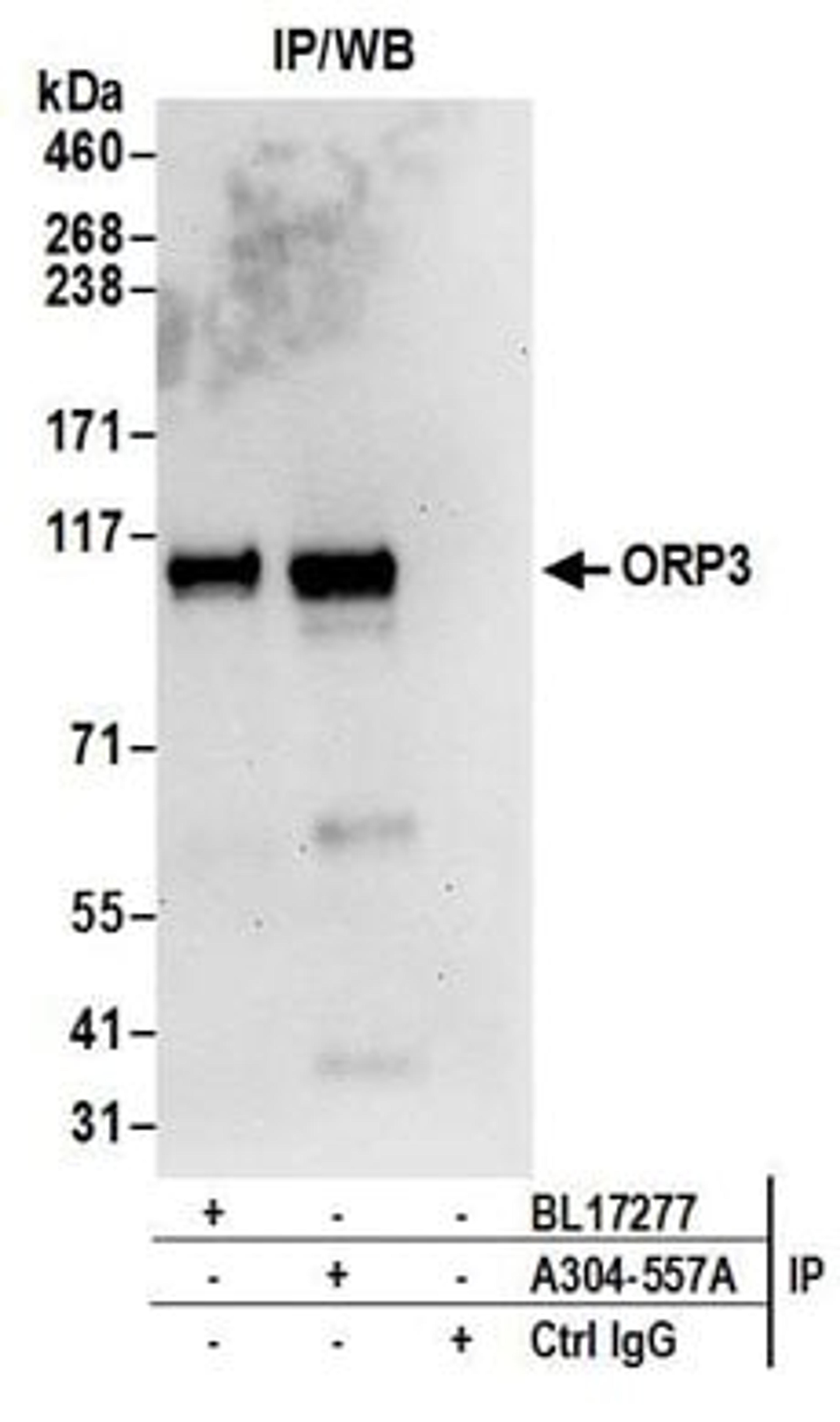 Detection of human ORP3 by western blot of immunoprecipitates.