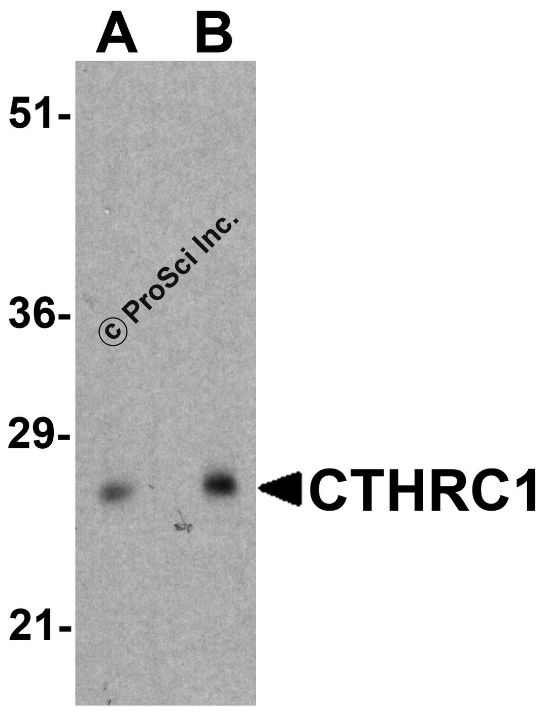 Western blot analysis of CTHRC1 in rat small intestine tissue lysate with CTHRC1 antibody at (A) 1 and (B) 2 μg/ml.