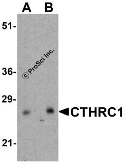 Western blot analysis of CTHRC1 in rat small intestine tissue lysate with CTHRC1 antibody at (A) 1 and (B) 2 μg/ml.