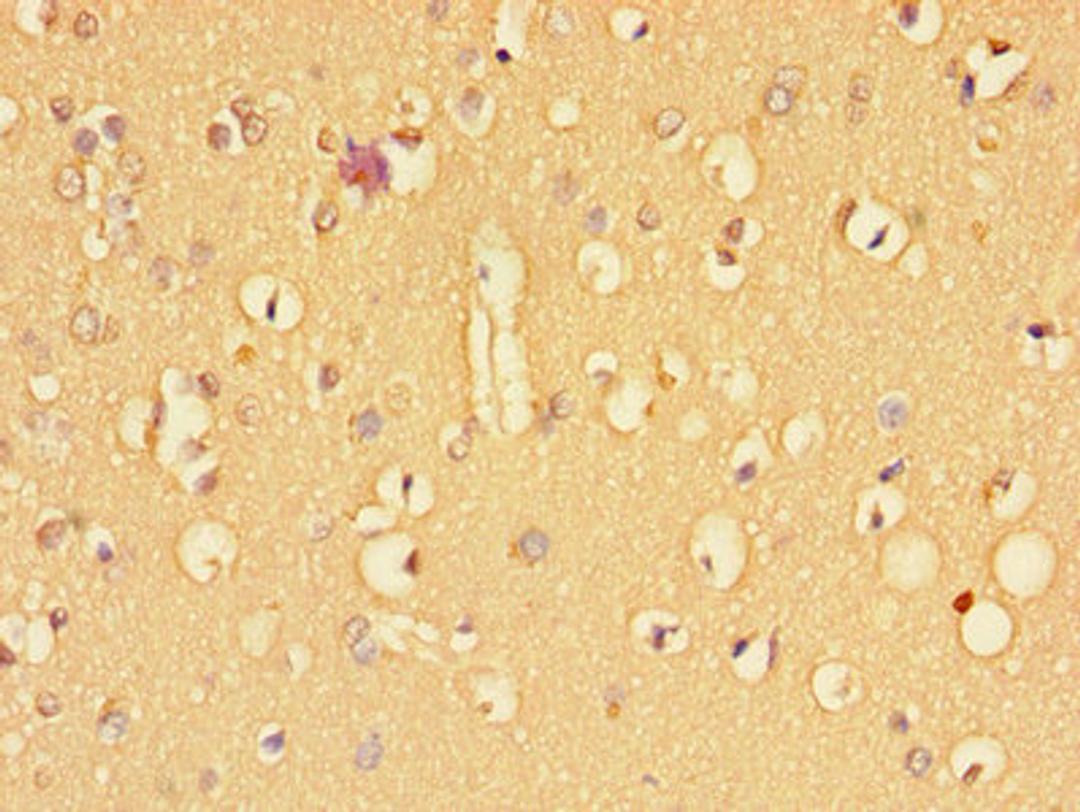 Immunohistochemistry of paraffin-embedded human brain tissue using CSB-PA023452LA01HU at dilution of 1:100