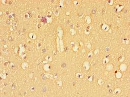 Immunohistochemistry of paraffin-embedded human brain tissue using CSB-PA023452LA01HU at dilution of 1:100