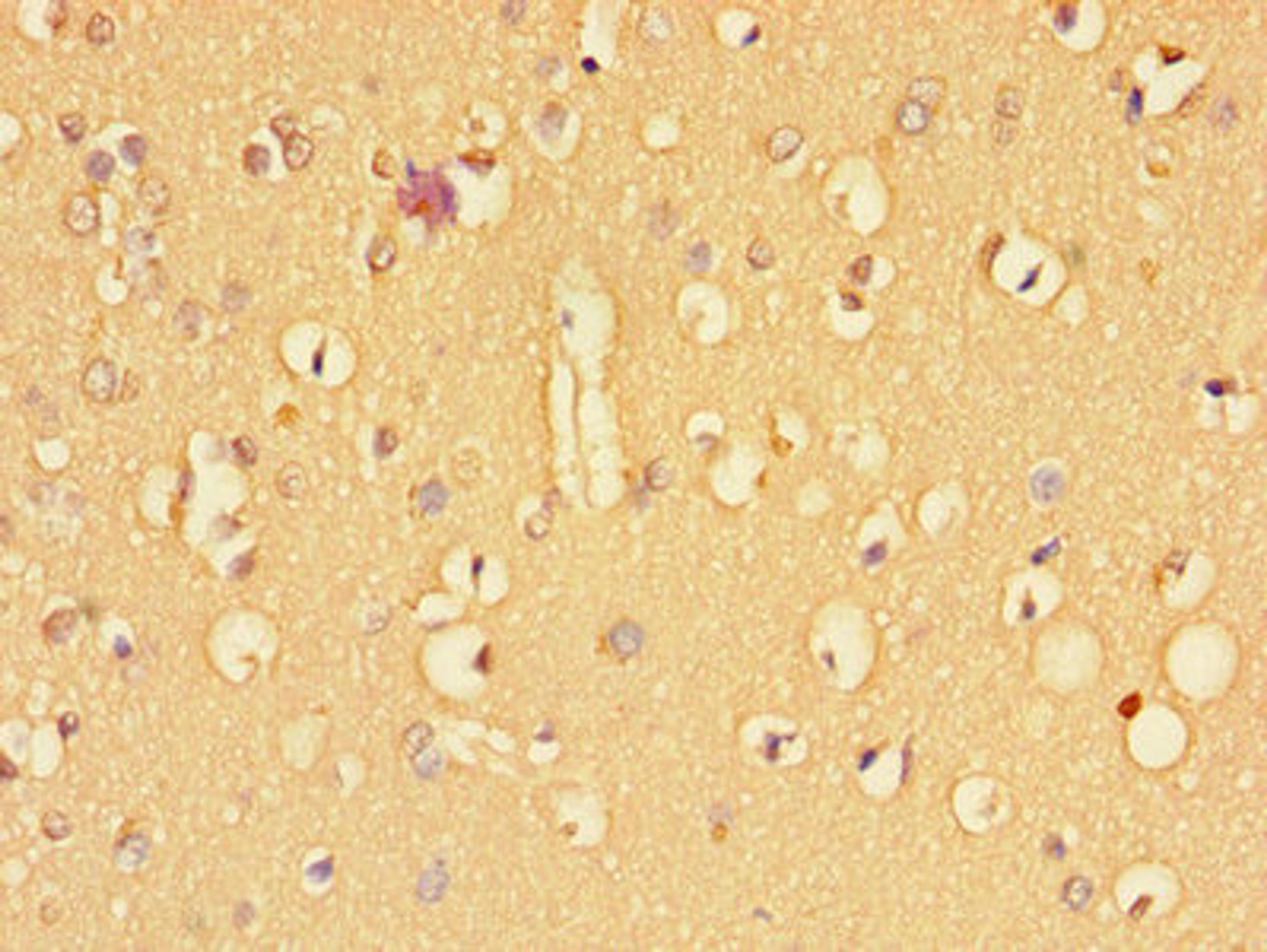 Immunohistochemistry of paraffin-embedded human brain tissue using CSB-PA023452LA01HU at dilution of 1:100