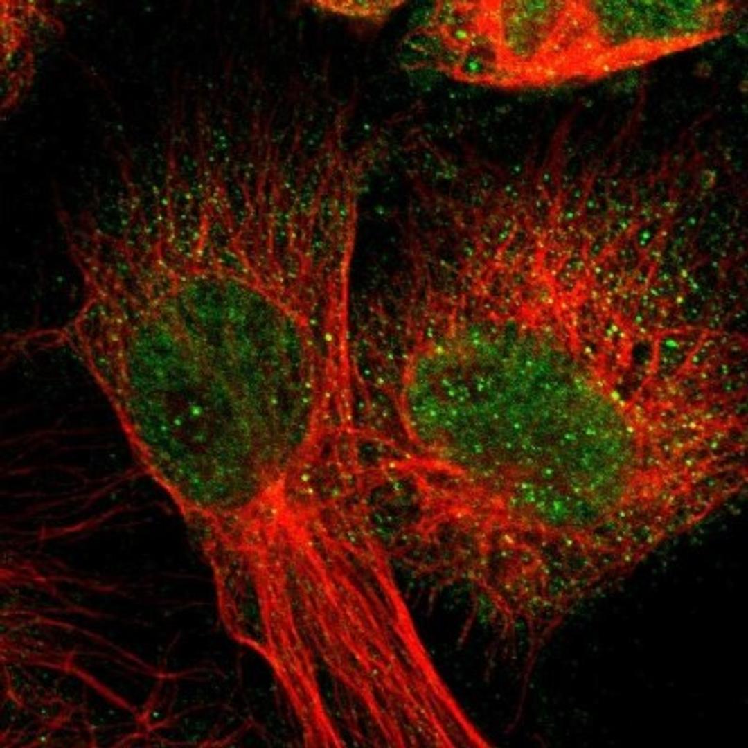 Immunocytochemistry/Immunofluorescence: CCDC22 Antibody [NBP1-84331] - Staining of human cell line U-251MG shows positivity in nucleus but not nucleoli & cytoplasm.