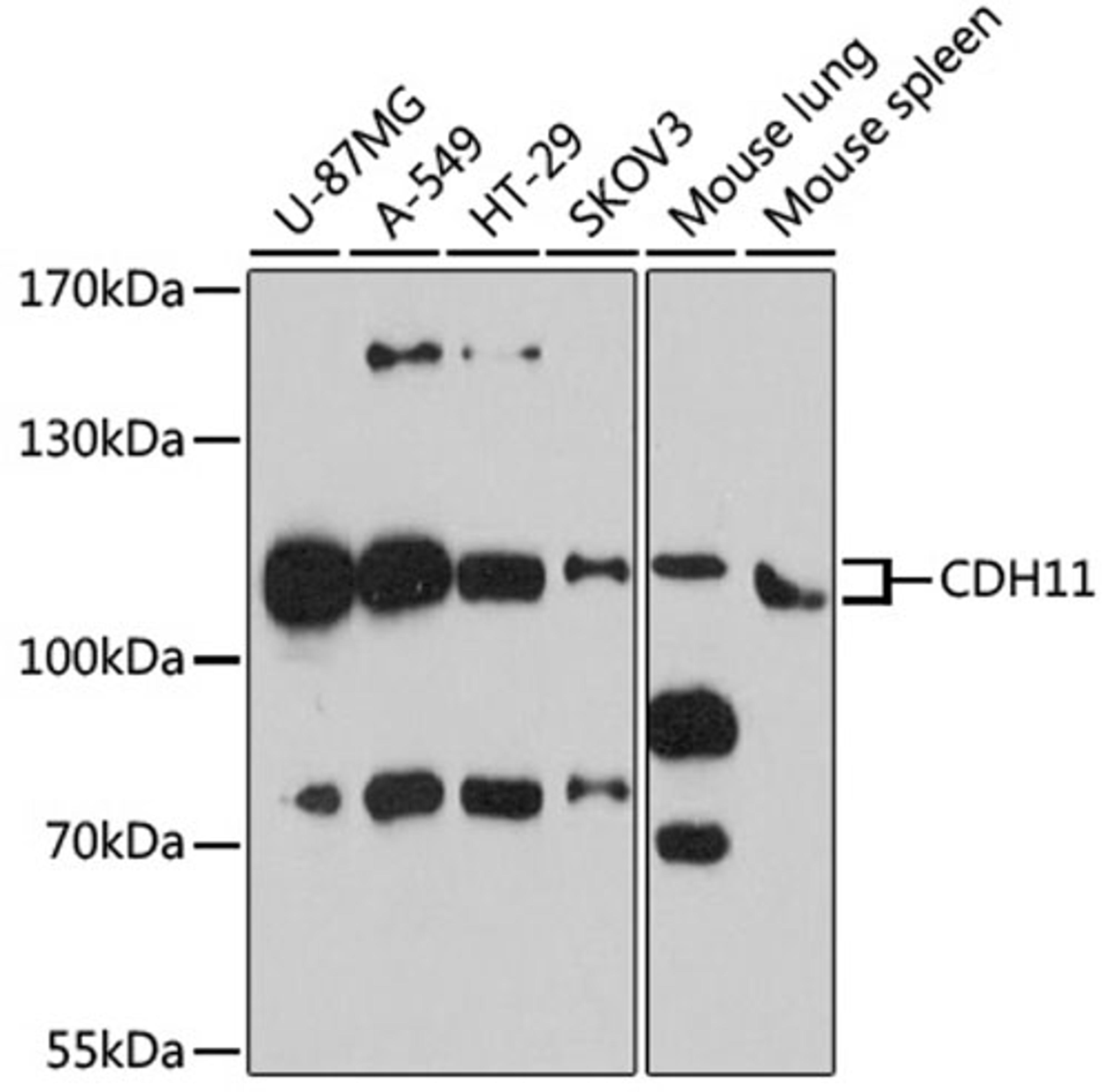 Western blot - CDH11 antibody (A8110)