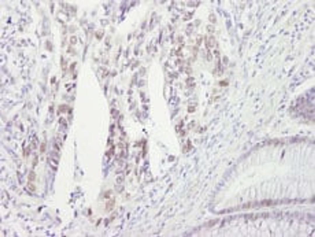 Detection of human CHK2 by immunohistochemistry.