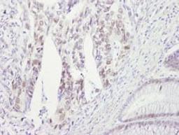 Detection of human CHK2 by immunohistochemistry.