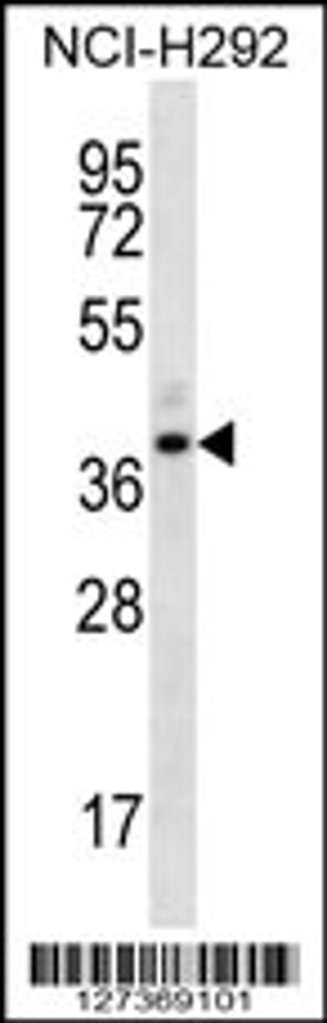 Western blot analysis in NCI-H292 cell line lysates (35ug/lane).