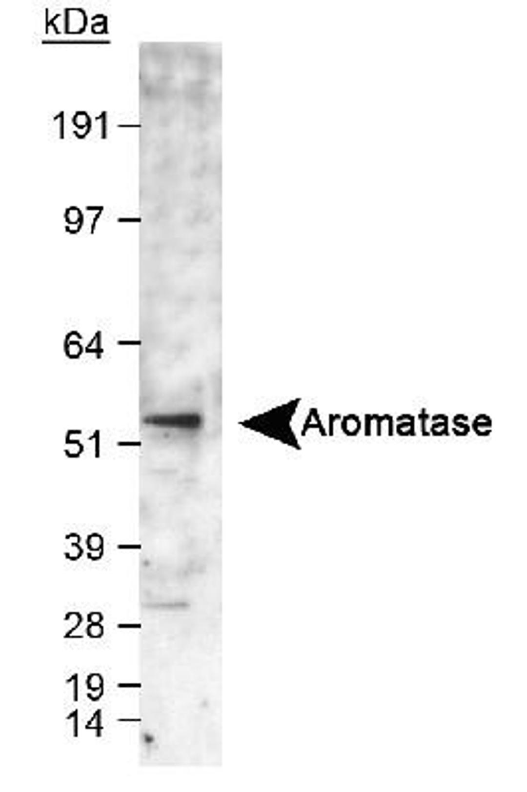 Western Blot: Aromatase Antibody [NB100-1596] - Detection of aromatase in human fetal temporal lobe lysate using NB 100-1596. ECL exposure, 1-2 minutes.