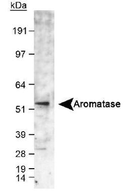 Western Blot: Aromatase Antibody [NB100-1596] - Detection of aromatase in human fetal temporal lobe lysate using NB 100-1596. ECL exposure, 1-2 minutes.