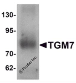 Western blot analysis of TGM7 in human lung tissue lysate with TGM7 antibody at 1 &#956;g/mL.