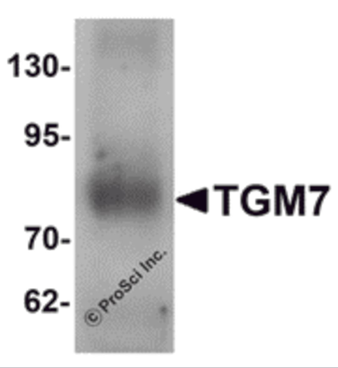 Western blot analysis of TGM7 in human lung tissue lysate with TGM7 antibody at 1 μg/mL.