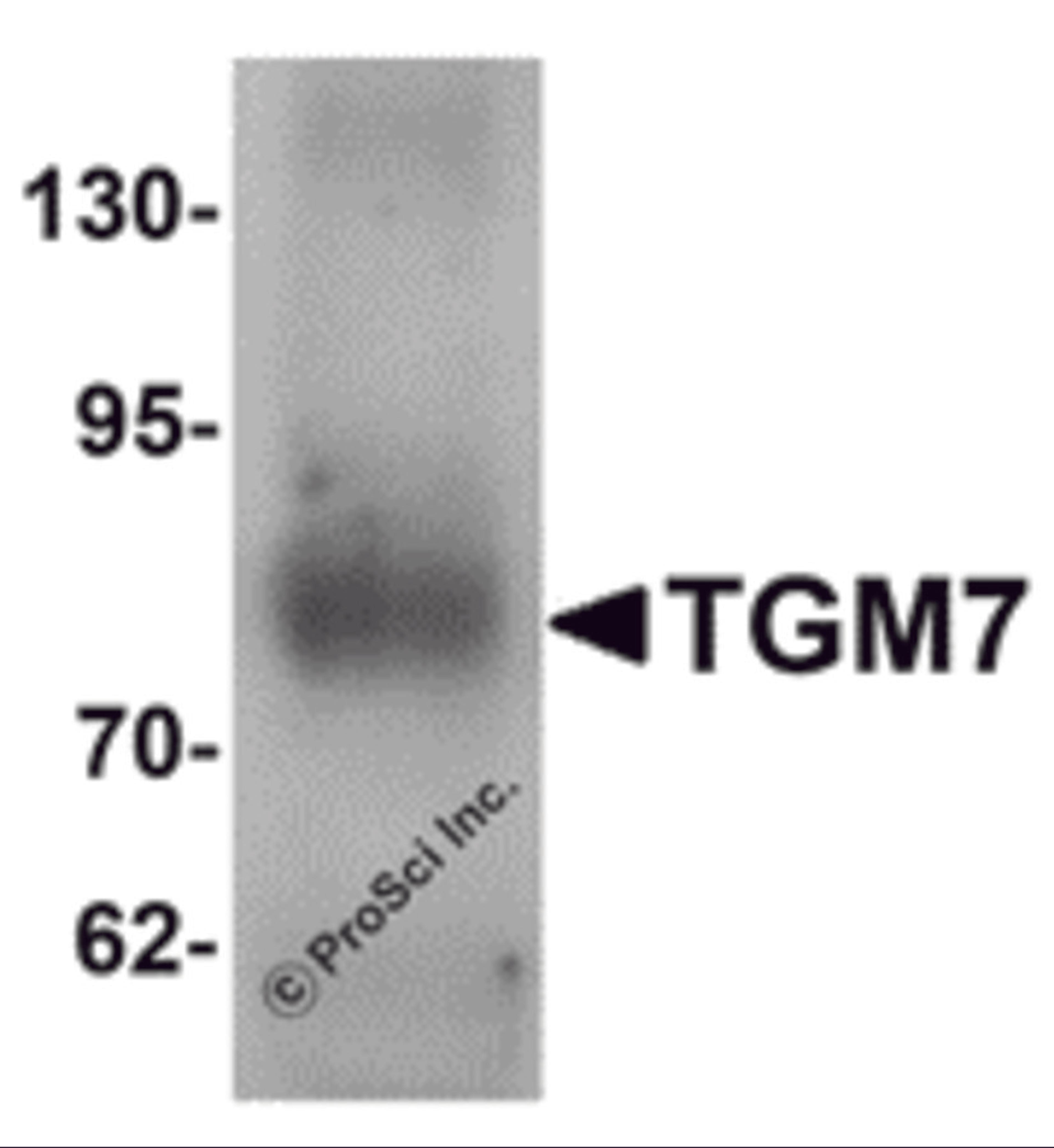Western blot analysis of TGM7 in human lung tissue lysate with TGM7 antibody at 1 μg/mL.