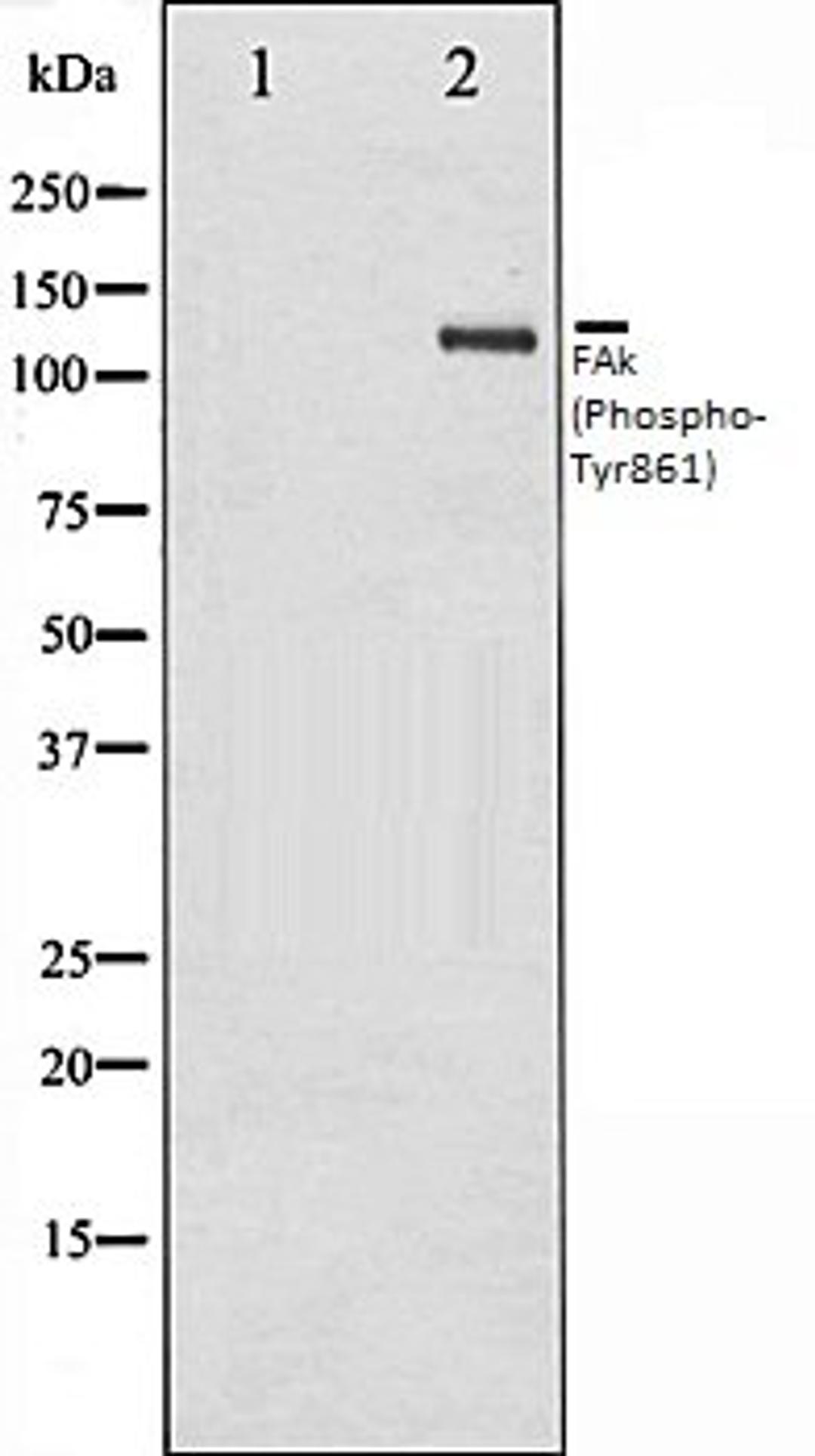 Western blot analysis of HepG2 whole cell lysates using FAK (Phospho-Tyr861) antibody, The lane on the left is treated with the antigen-specific peptide.