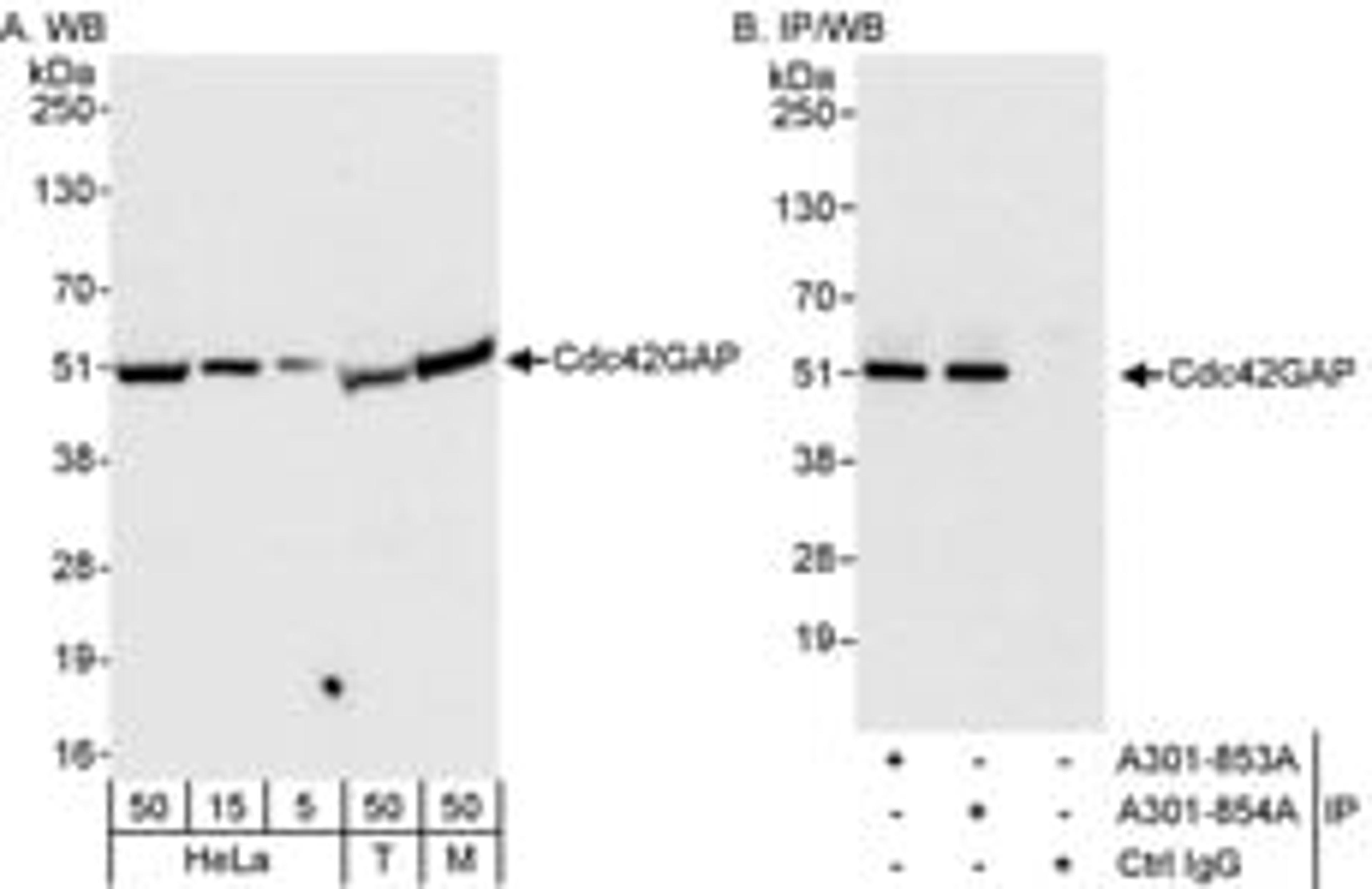 Detection of human and mouse Cdc42GAP by western blot (h&m) and immunoprecipitation (h).