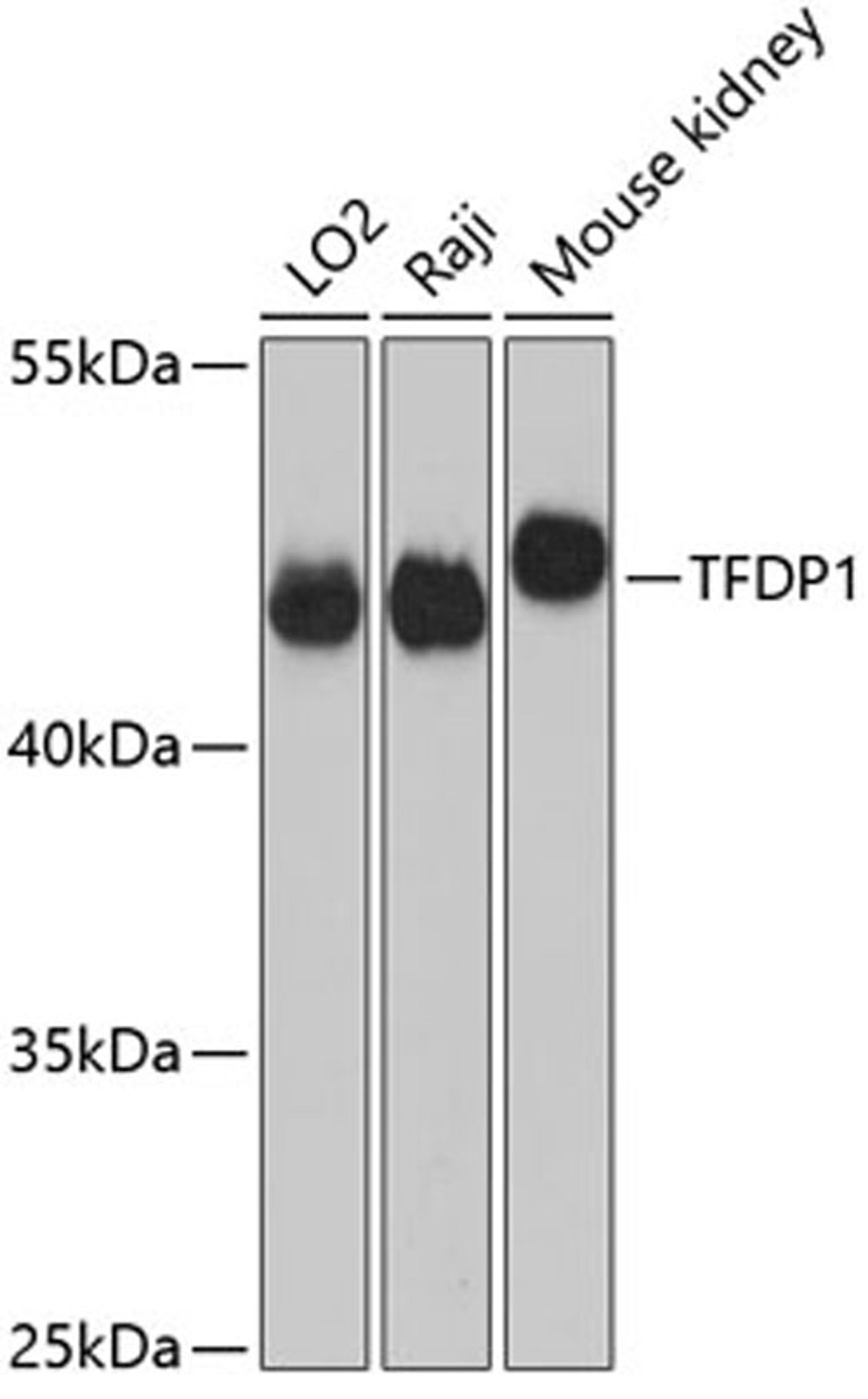 Western blot - TFDP1 antibody (A5422)