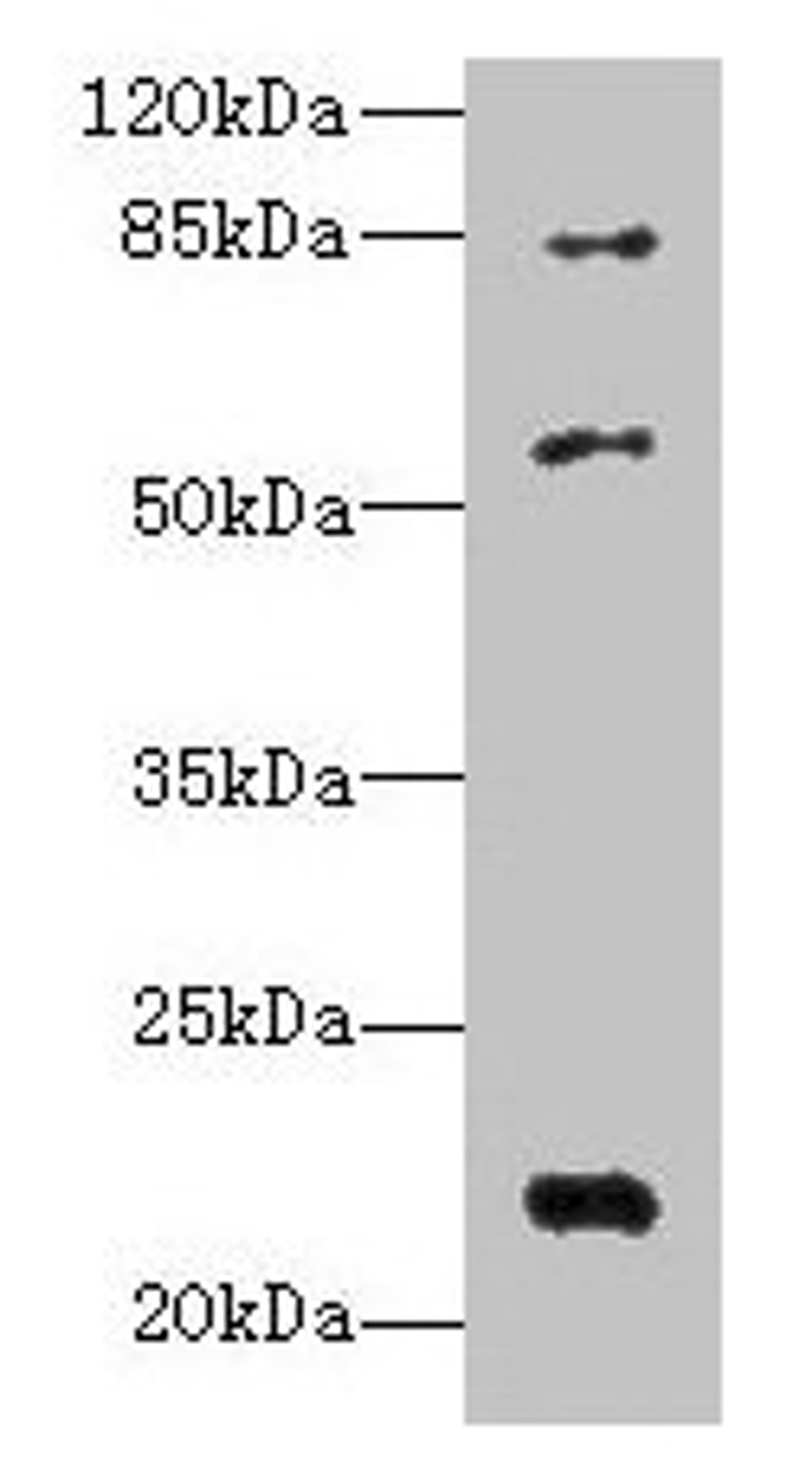 Western blot. All lanes: PYHIN1 antibody at 6µg/ml + Mouse small intestine tissue. Secondary. Goat polyclonal to rabbit IgG at 1/10000 dilution. Predicted band size: 56, 55, 52, 51, 27, 26 kDa. Observed band size: 56, 22, 84 kDa