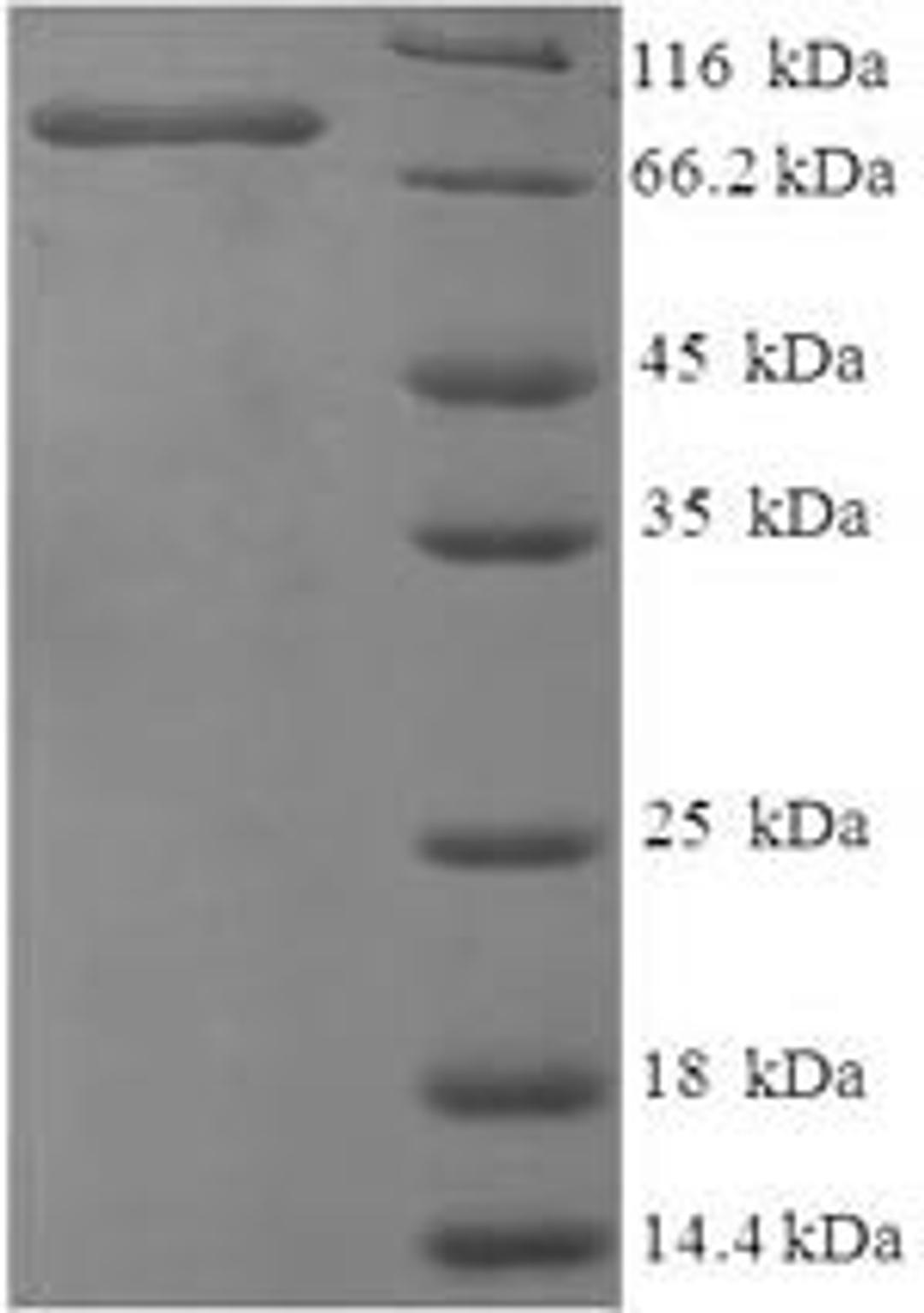 (Tris-Glycine gel) Discontinuous SDS-PAGE (reduced) with 5% enrichment gel and 15% separation gel.