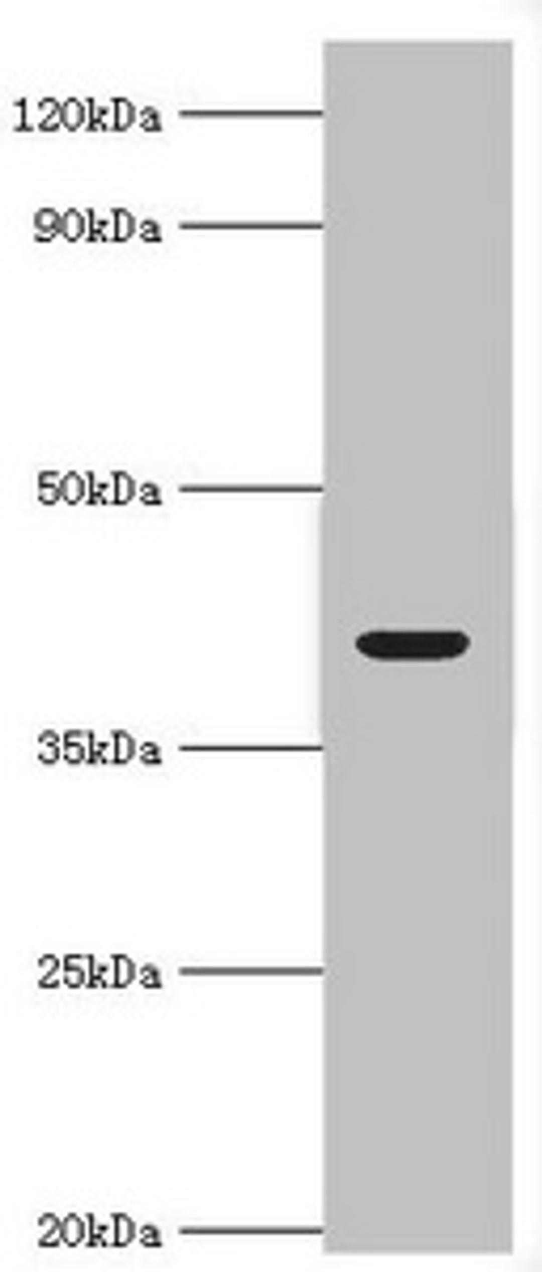 Western blot. All lanes: Alcohol dehydrogenase 4 antibody at 2ug/ml + Mouse liver tissue. Secondary. Goat polyclonal to rabbit IgG at 1/10000 dilution. Predicted band size: 41, 43 kDa. Observed band size: 41 kDa.